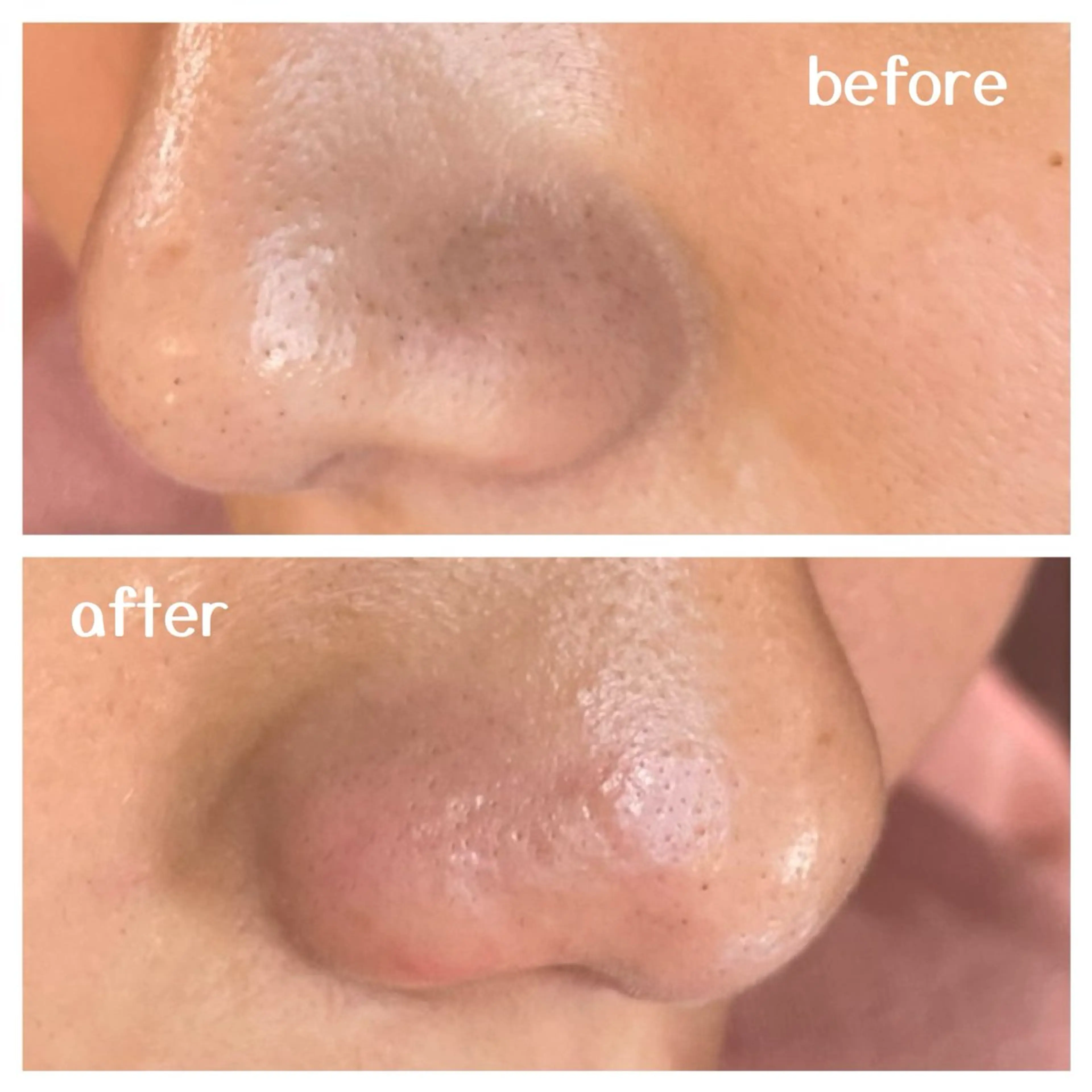 肌質改善エステ chiffonのエステ・リラクイメージ