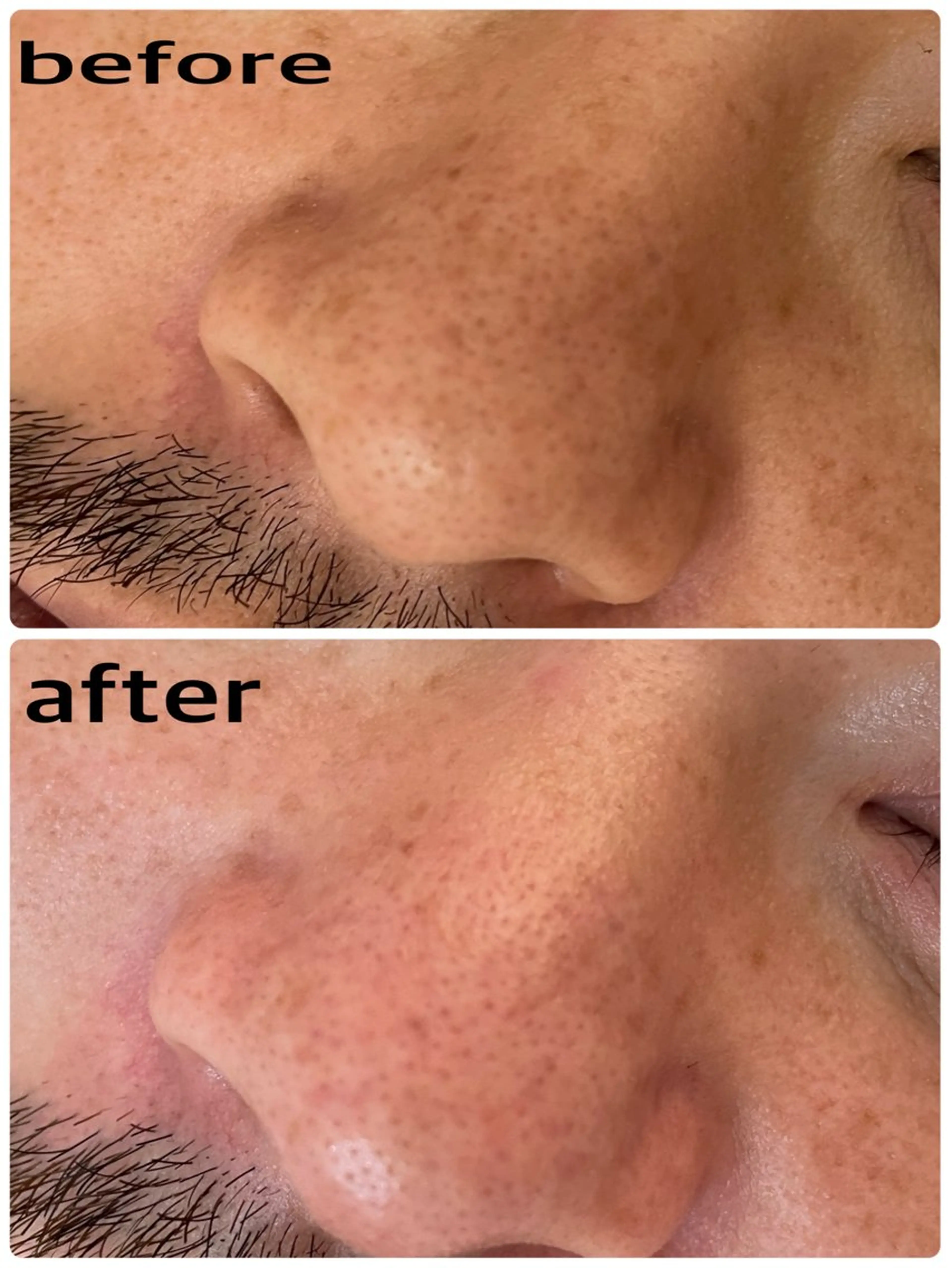 エステ une mizuhoの眉毛・アイブロウイメージ