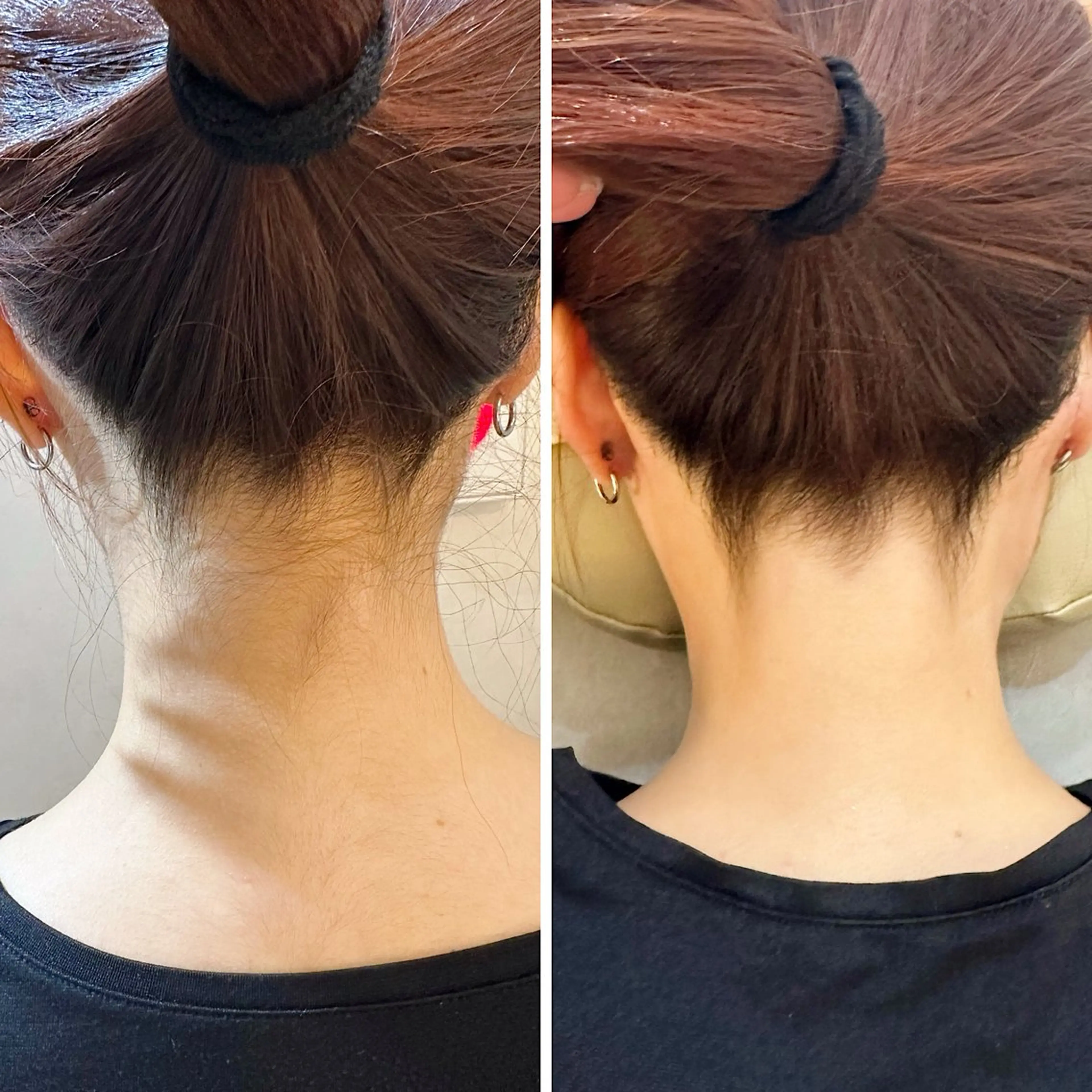 脱毛 うなじ脱毛/美肌脱毛 LABELのエステ・リラクイメージ