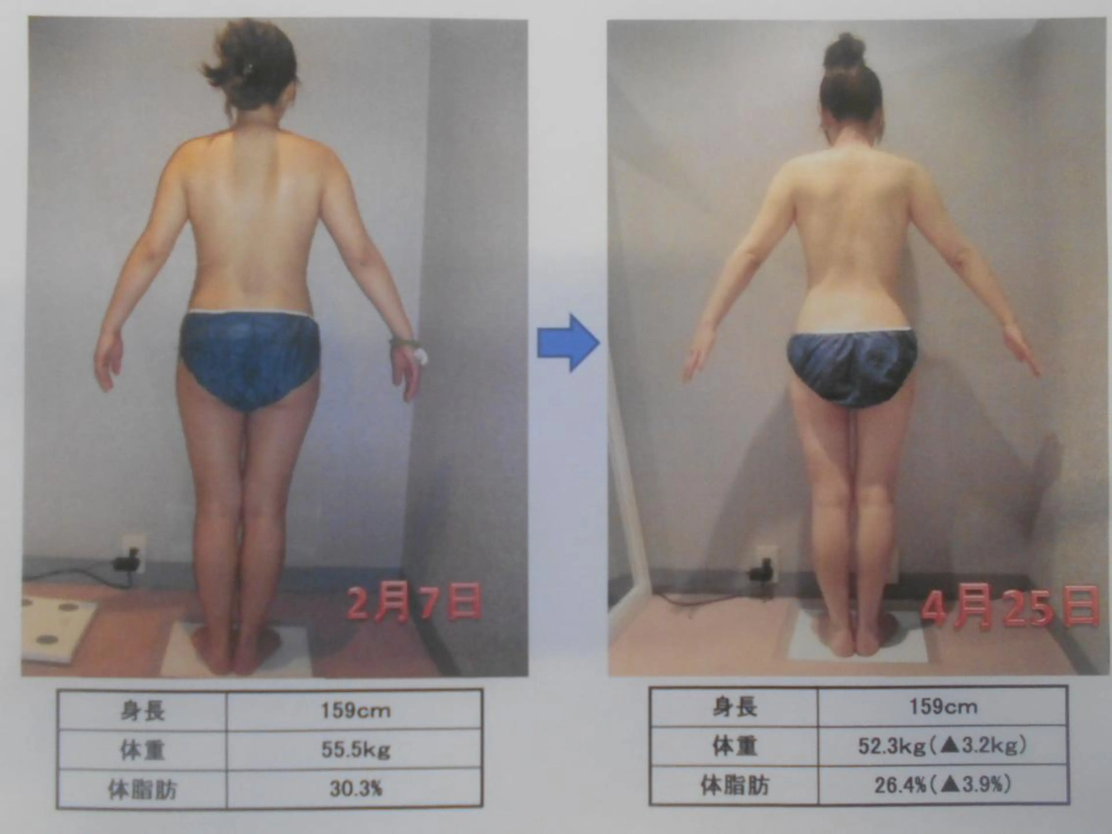 肩こり/首こり/ 小出愛のその他イメージ