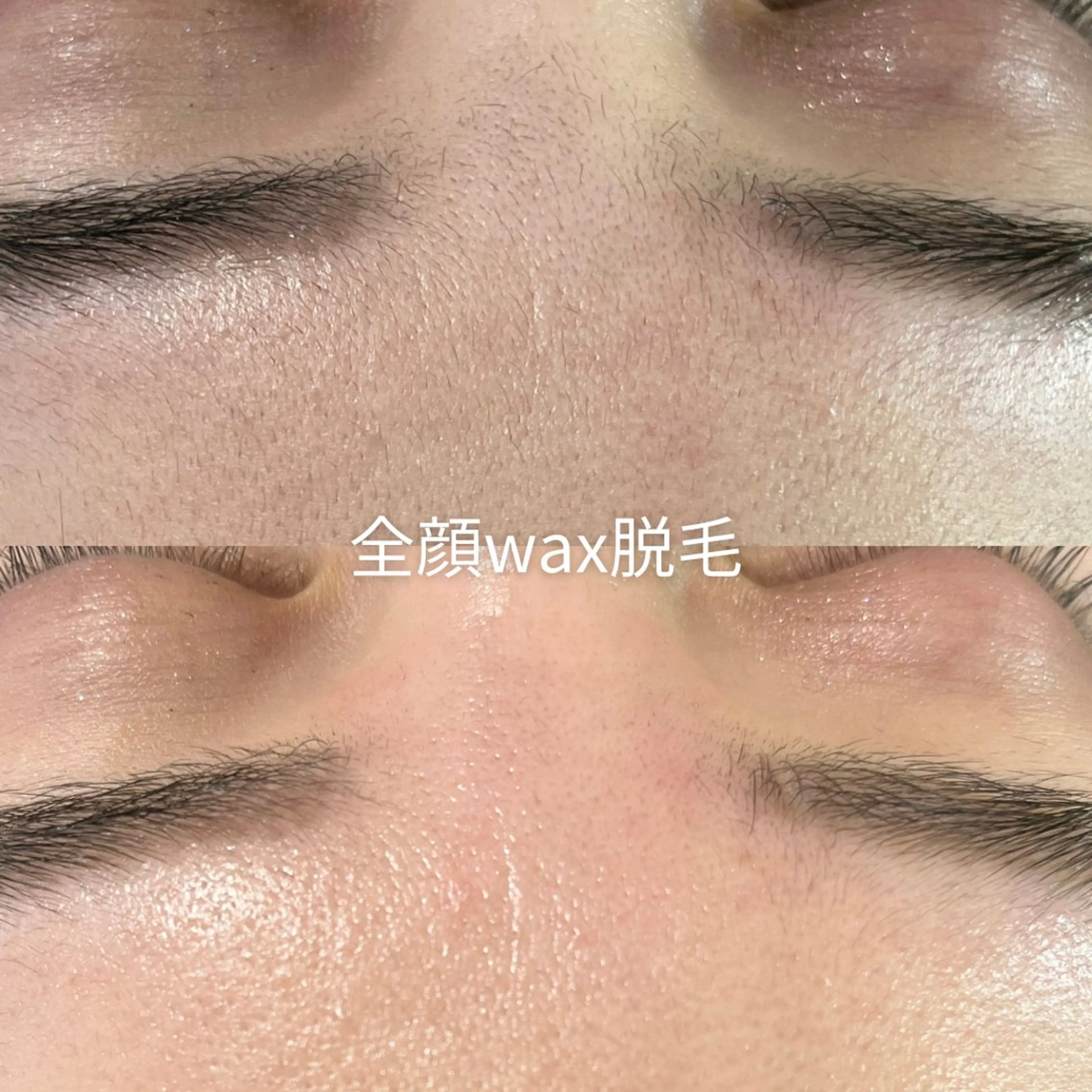 脱毛 EST BEAUTY所属・顔ワックス脱毛/ ハーブピーリングのエステ・リラクイメージ