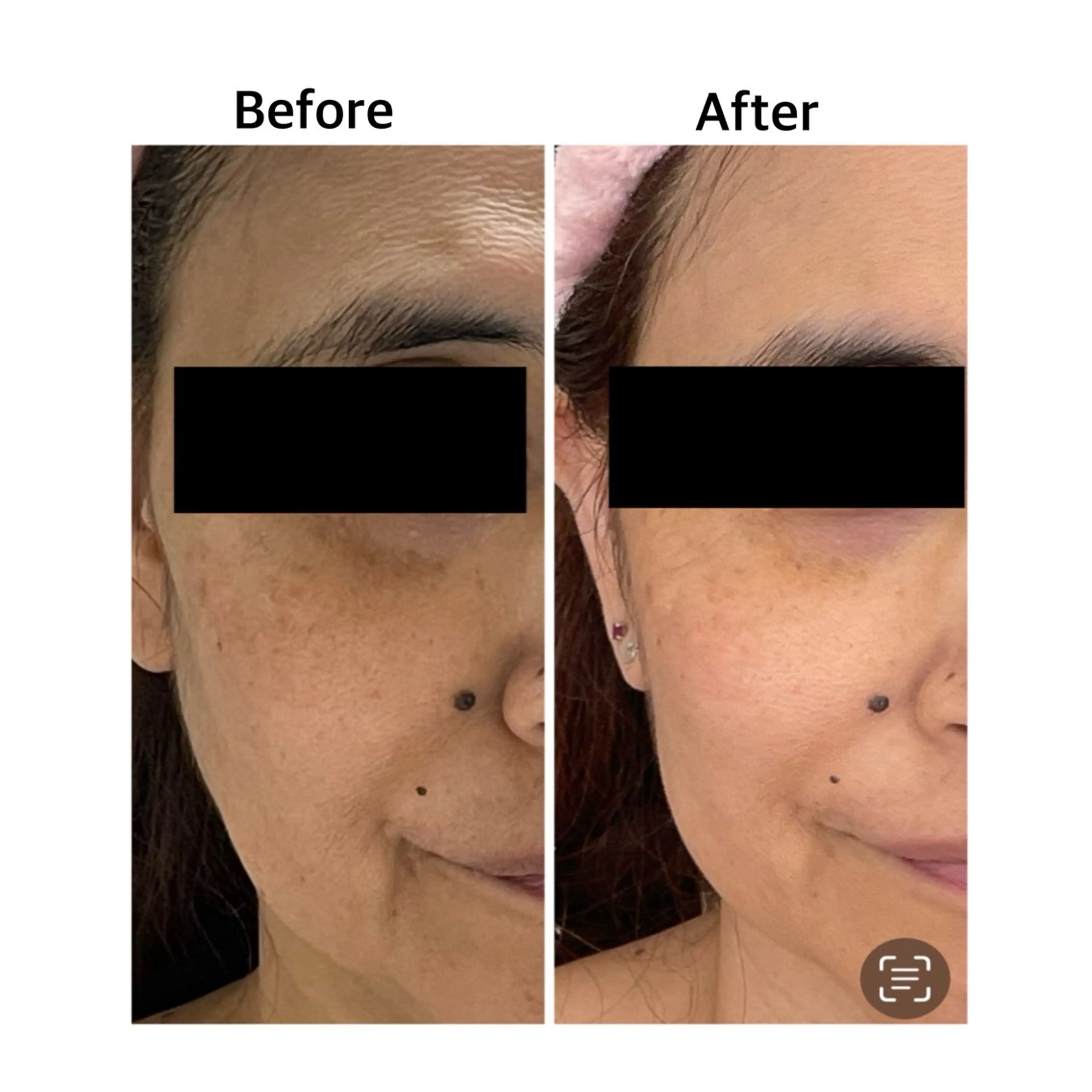 エステ 小顔・デトックスリンパ専門サロンRadiant Muse (ラディアントミューズ)所属・小顔・たるみ改善 ラディアントミューズのエステ・リラクイメージ