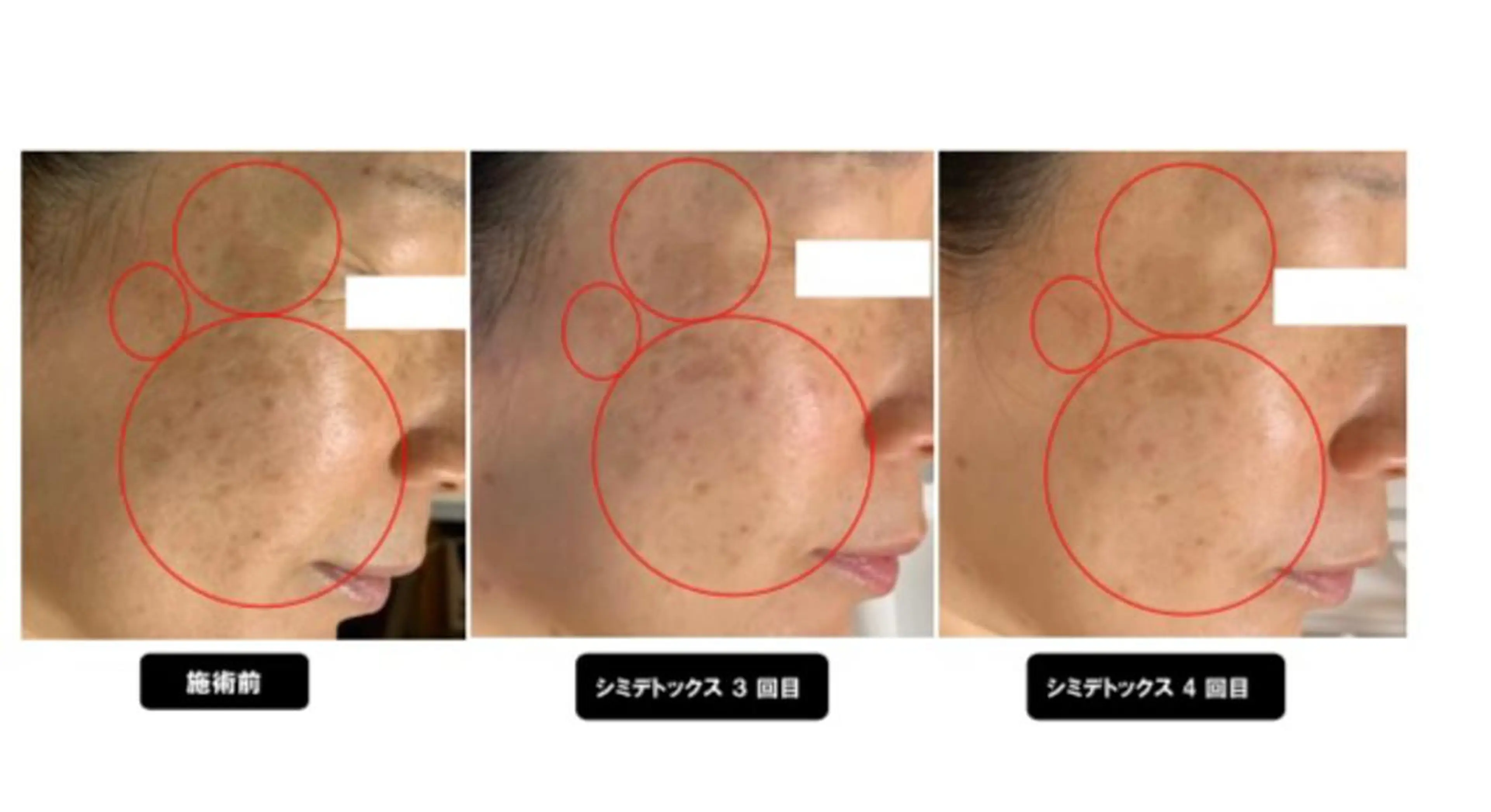 エステ ヴィーナス ビューティーのエステ・リラクイメージ