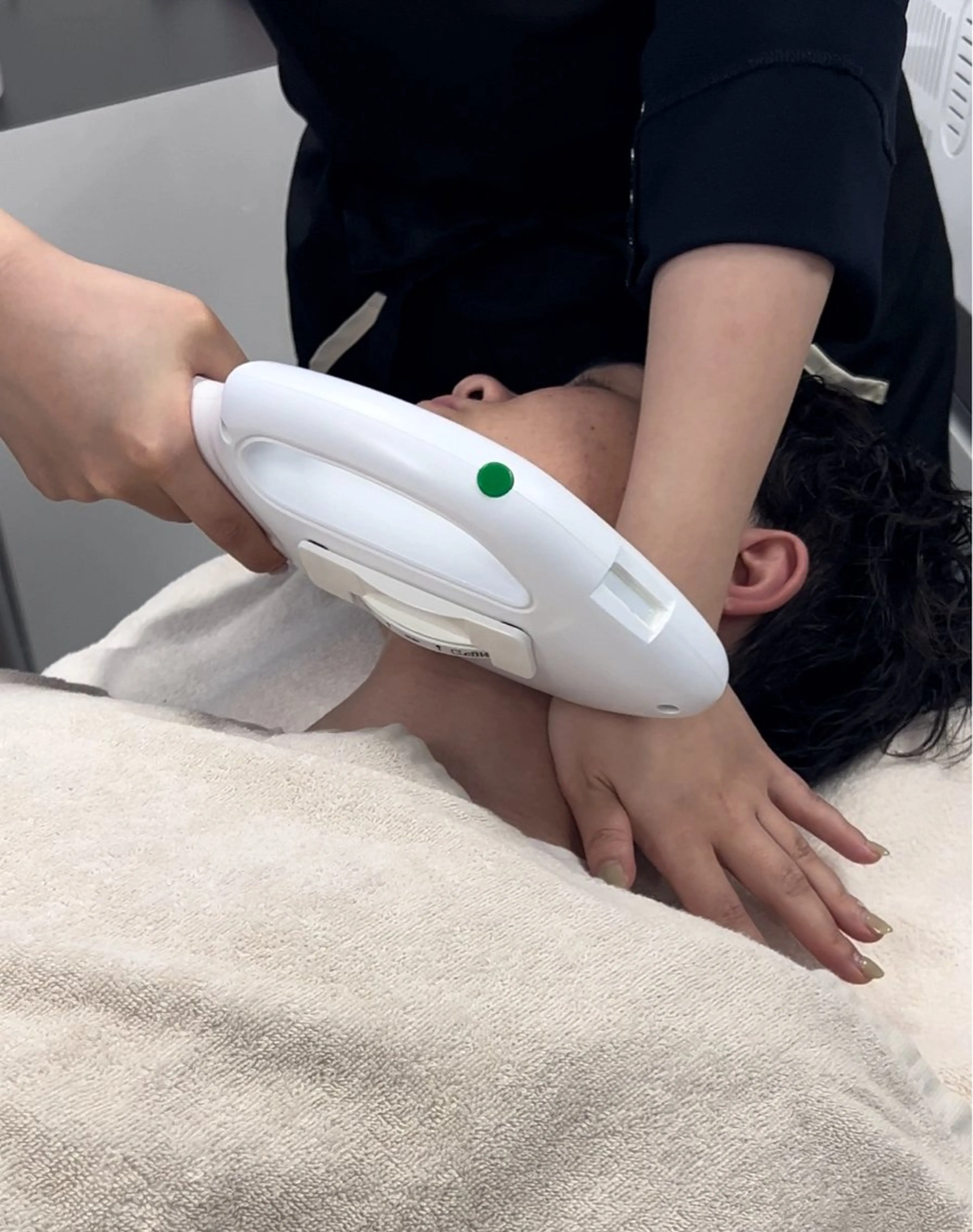 メンズ お顔脱毛✨の写真