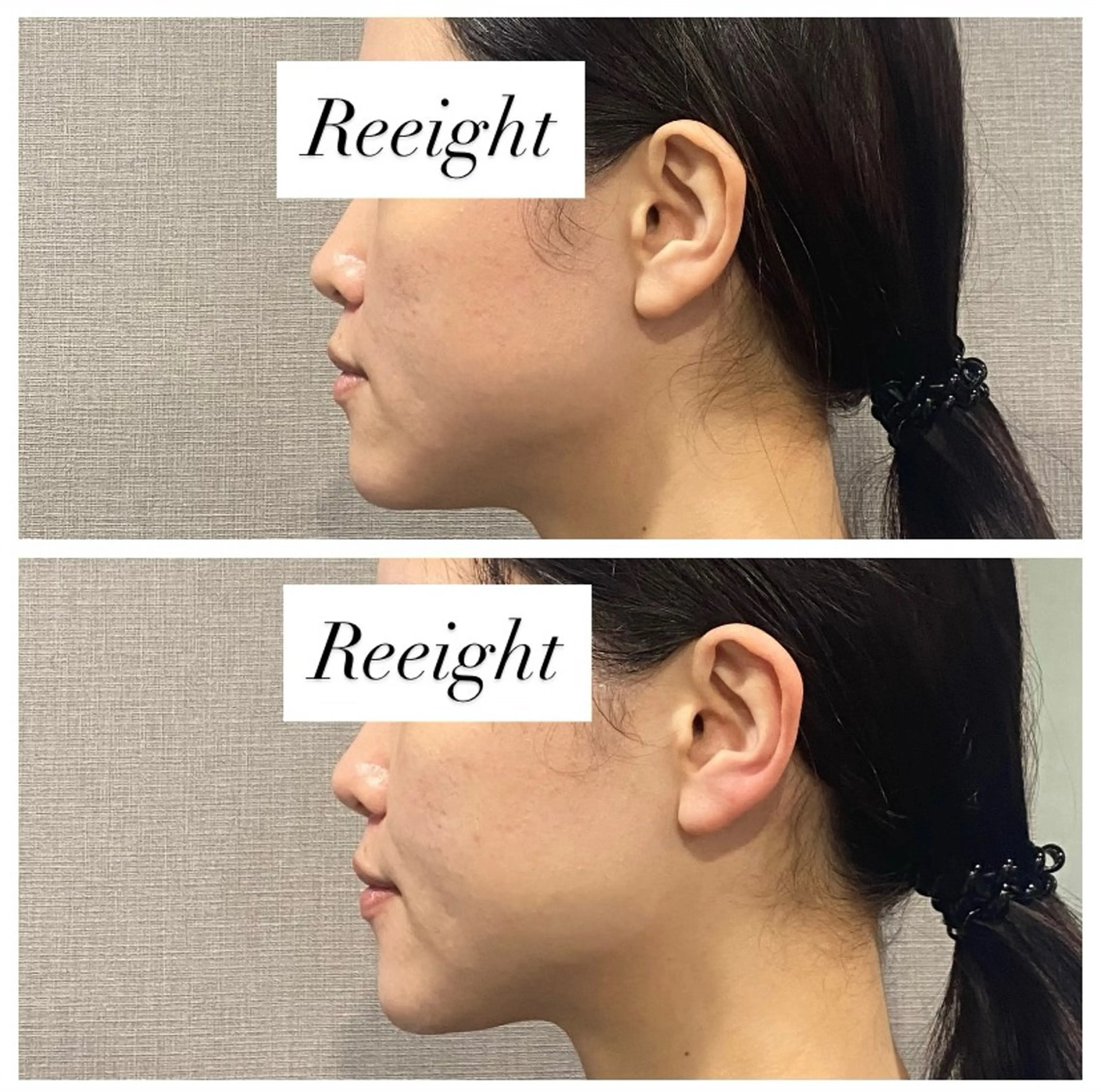 エステ 肌質改善専門 ハーブ /毛穴洗浄 リエイトのエステ・リラクイメージ