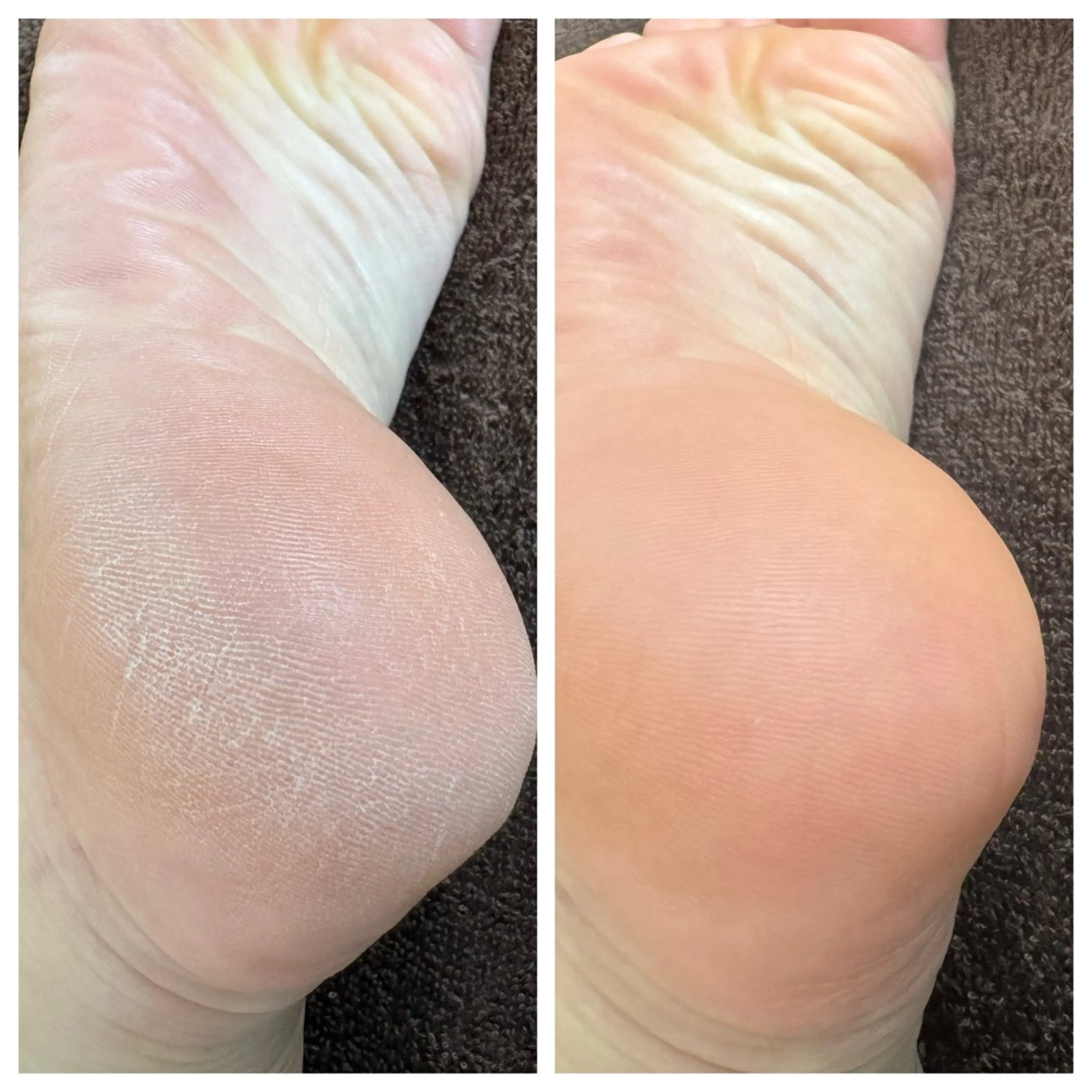 その他(ネイル) chou. chouのエステ・リラクイメージ