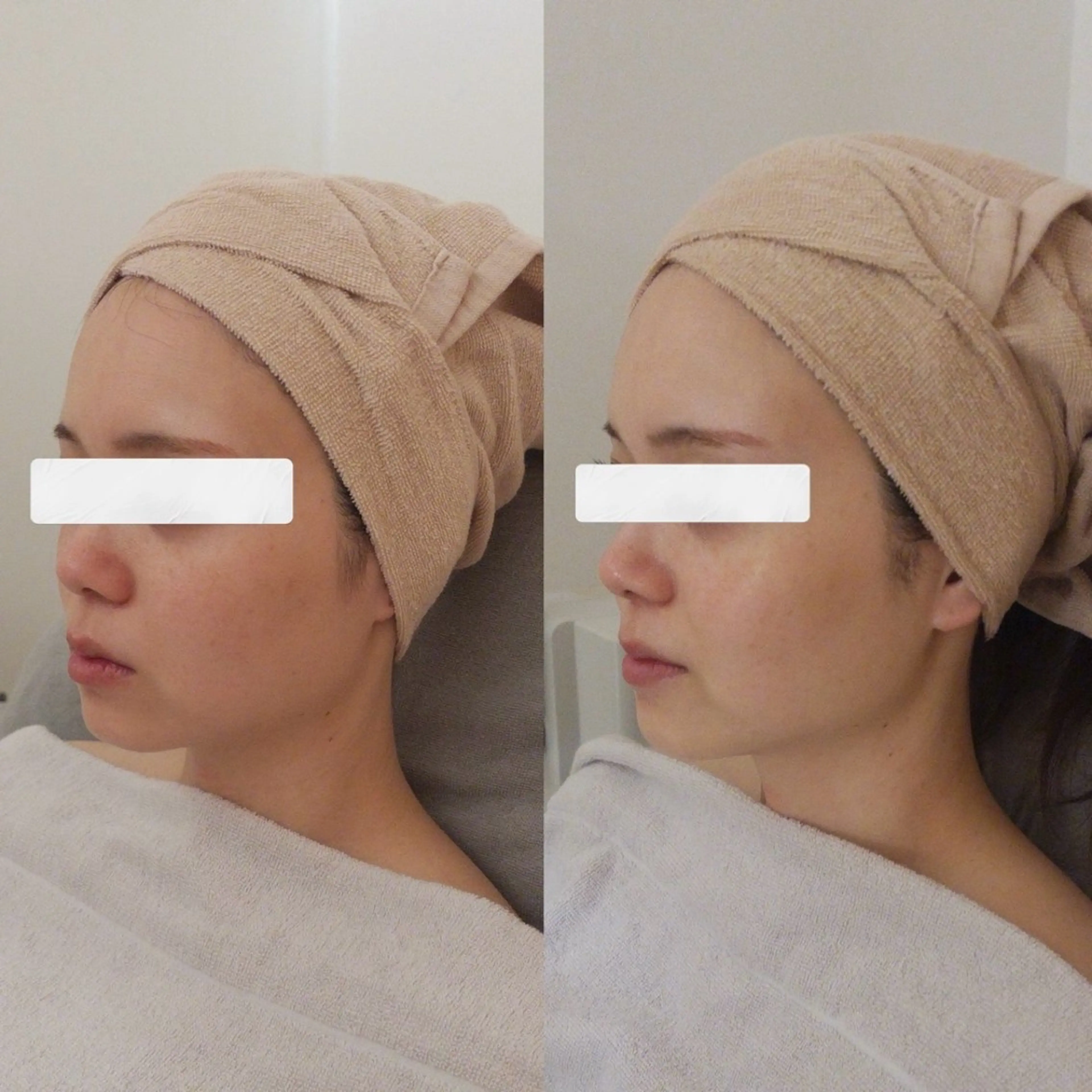 【無料】エステモデルの写真