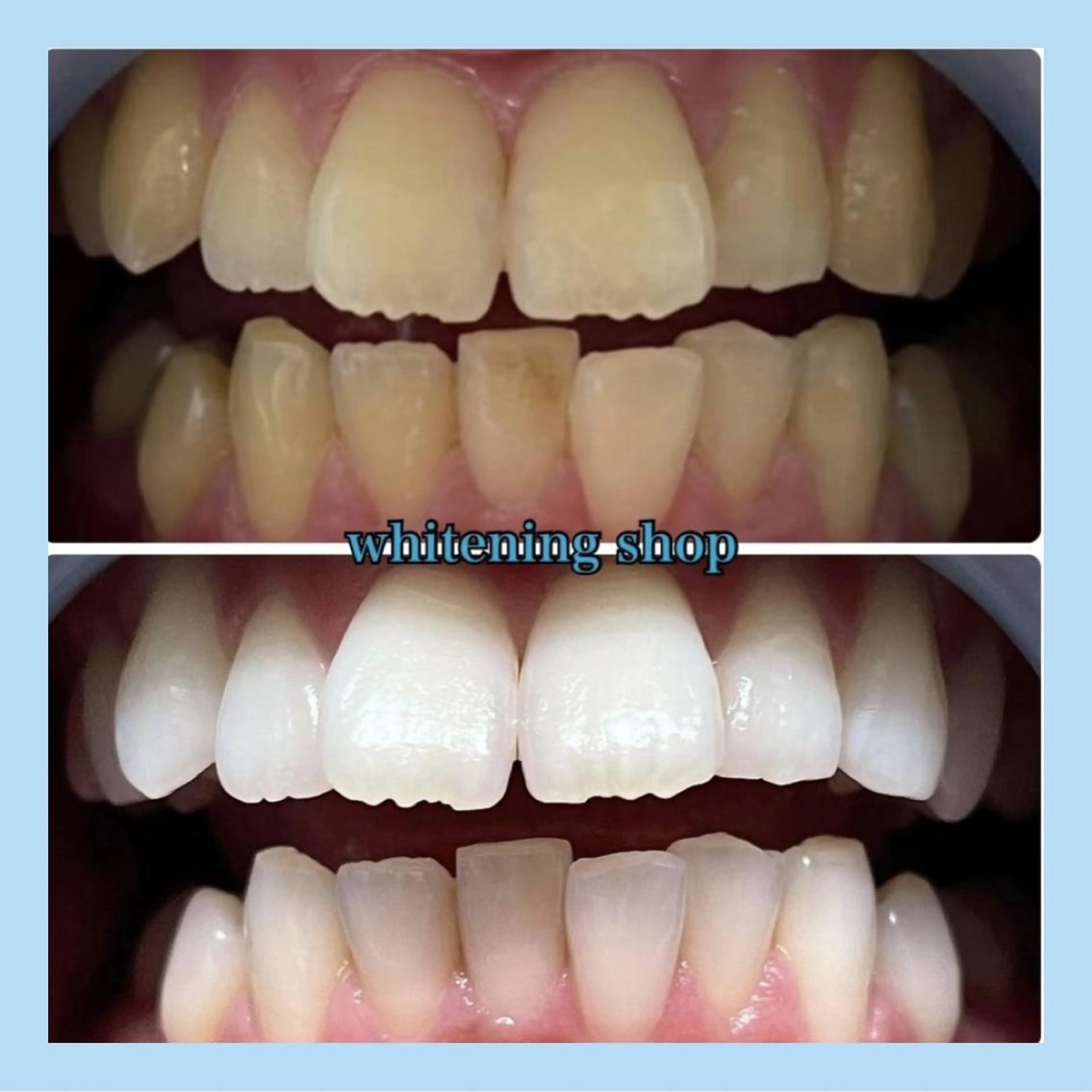 エステ ホワイトニング ショップ千葉店のその他イメージ