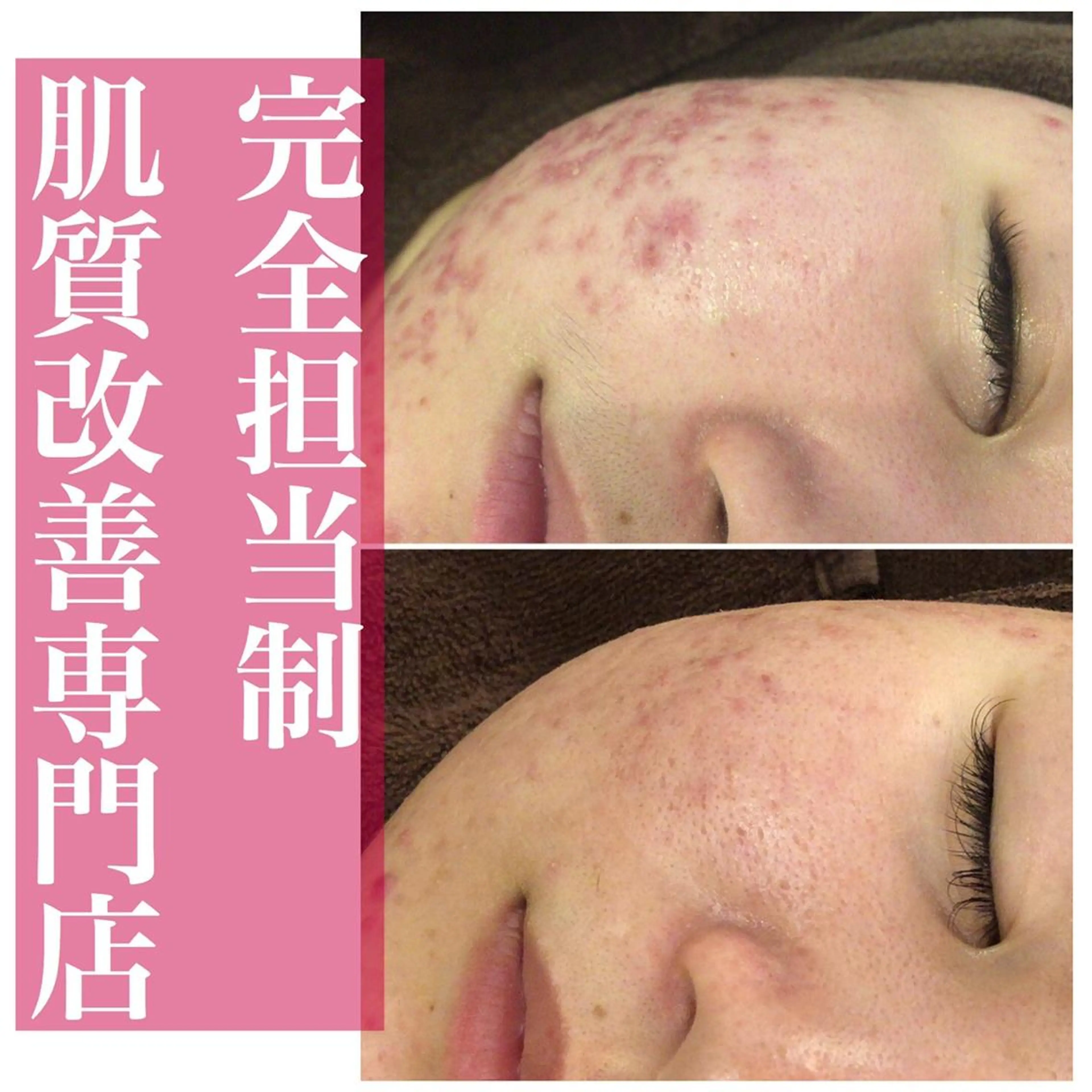 ミディアム カラー パーマ ヘアアレンジ メンズ キッズ ネイル マツエク・マツパ アイブロウ ニキビ・肌質改善専門 ♡人生が変わるサロンのエステ・リラクイメージ