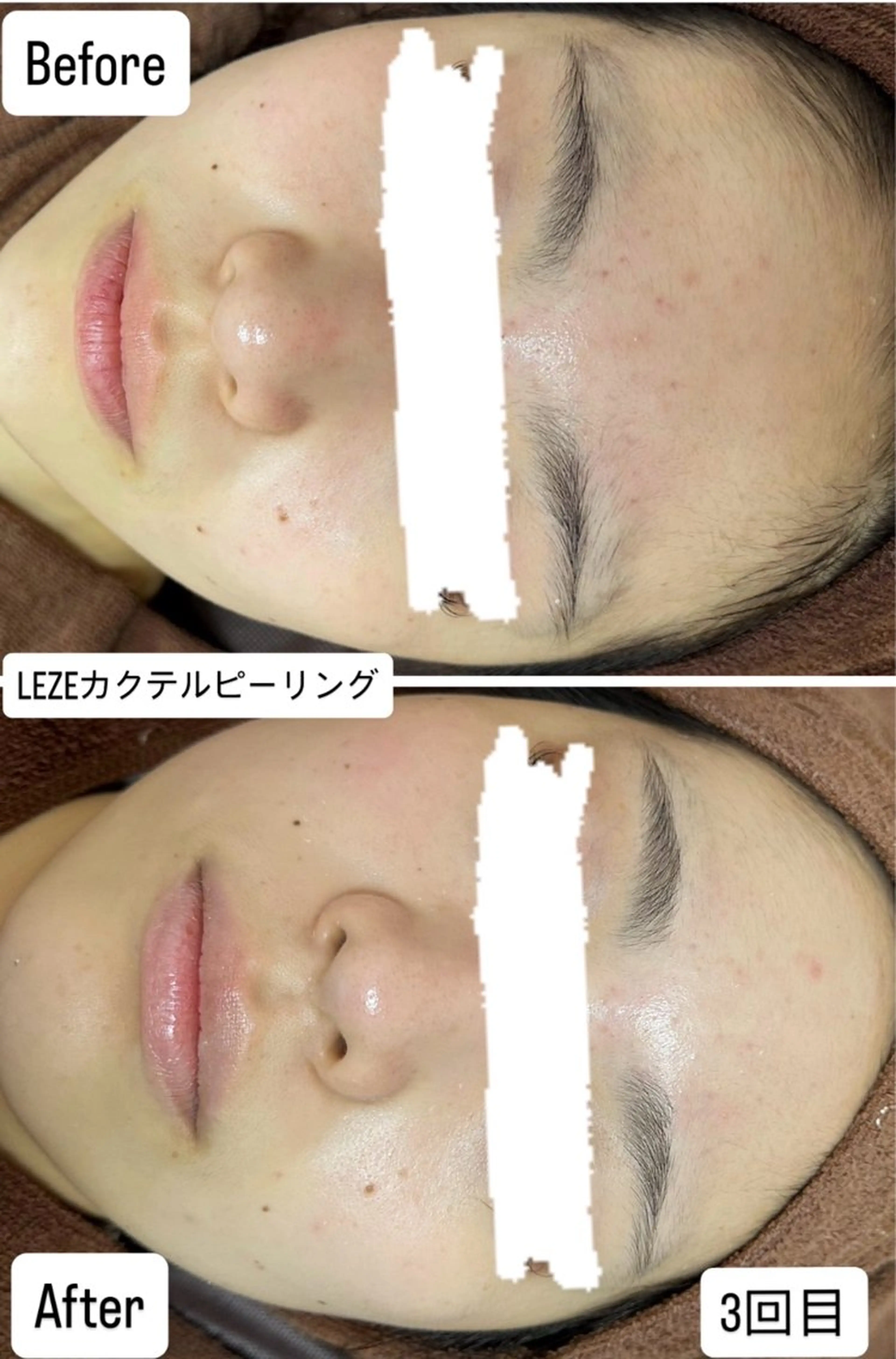 エステ 桐山 まどかのその他イメージ