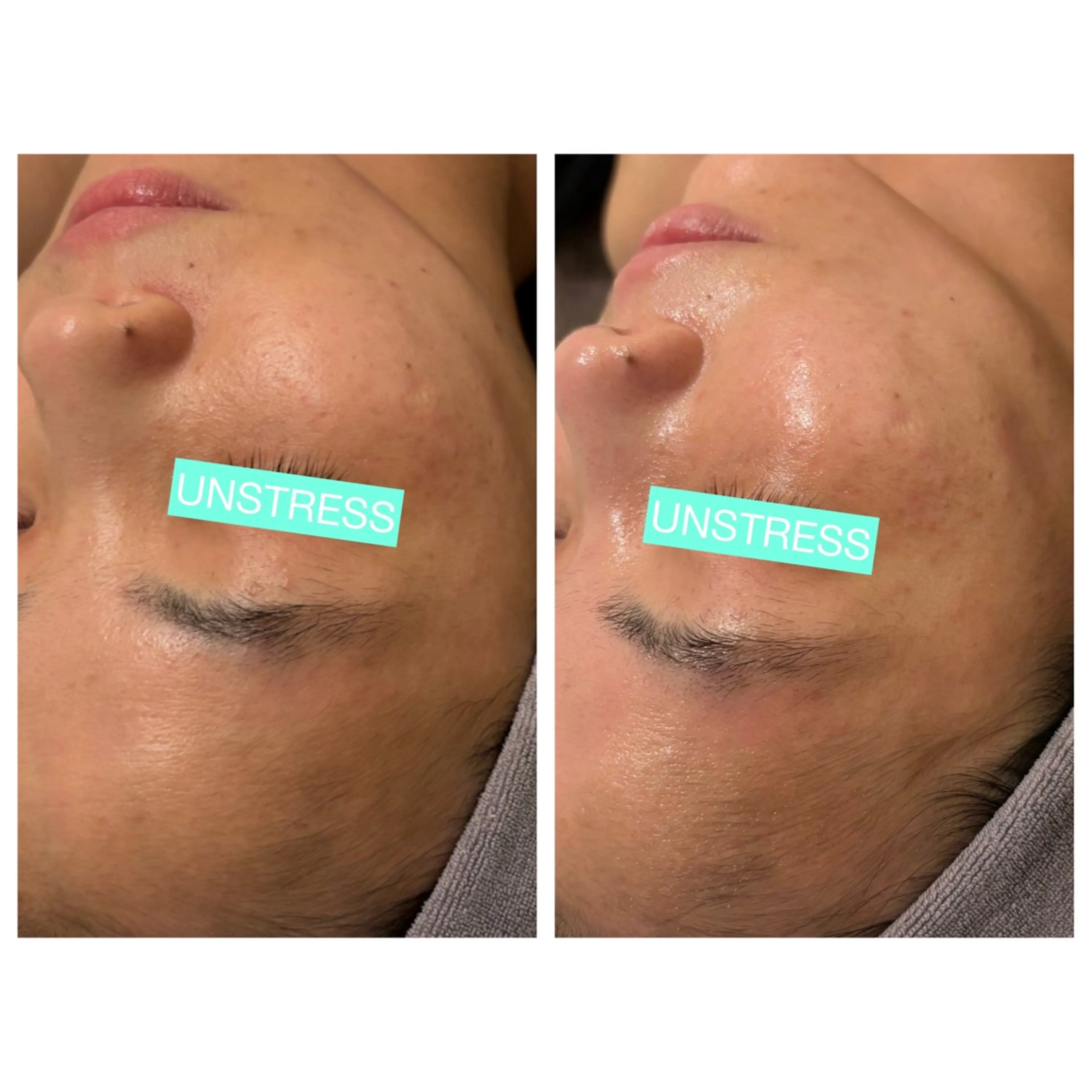 ☆痩身/小顔☆ コルギのエステ・リラクイメージ