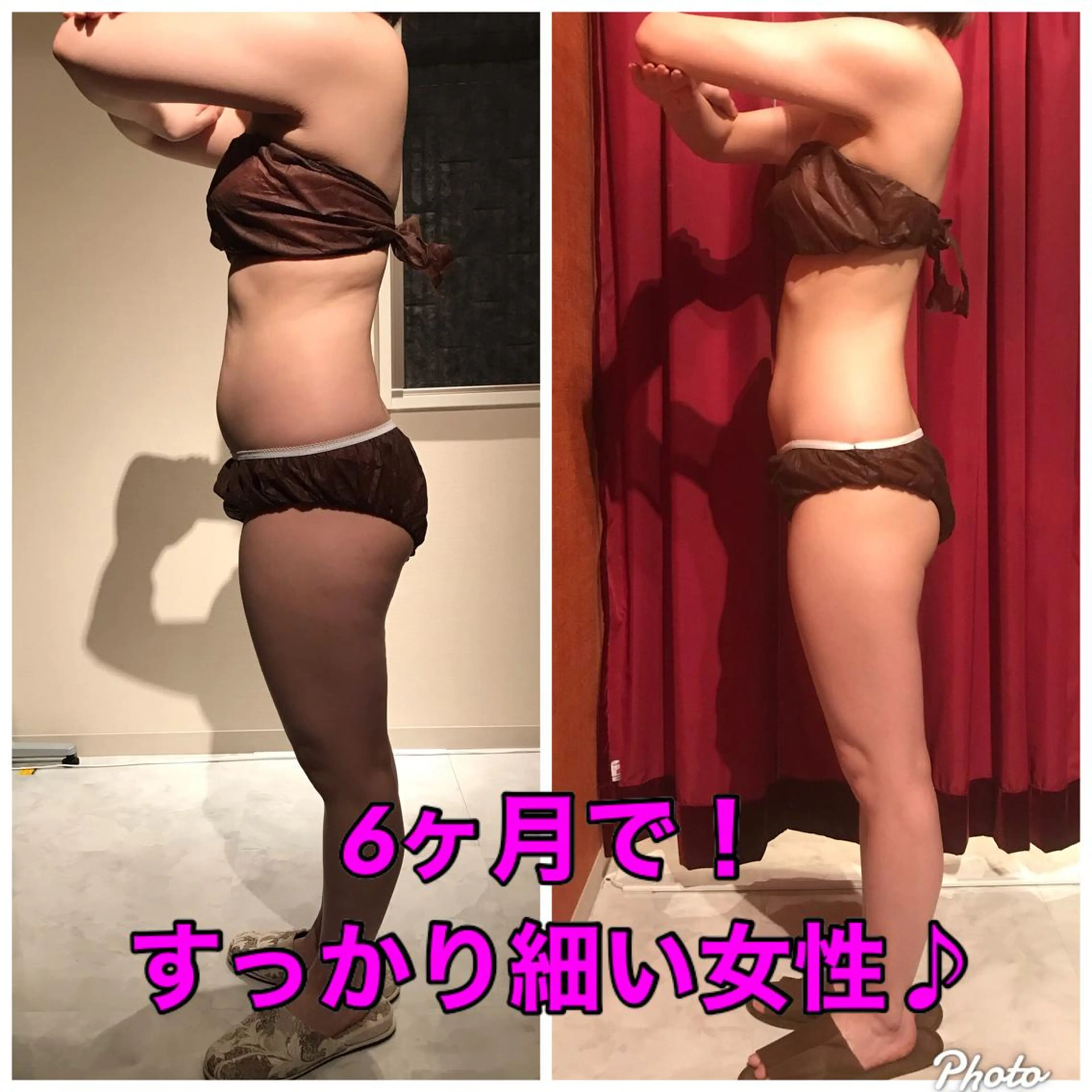 【カスタマイズ痩身60】造形ハンド＆セル撃退マシンで効果実感◎人気のダイエットメニュー★くびれ、脚痩せ、二の腕痩せ★の写真