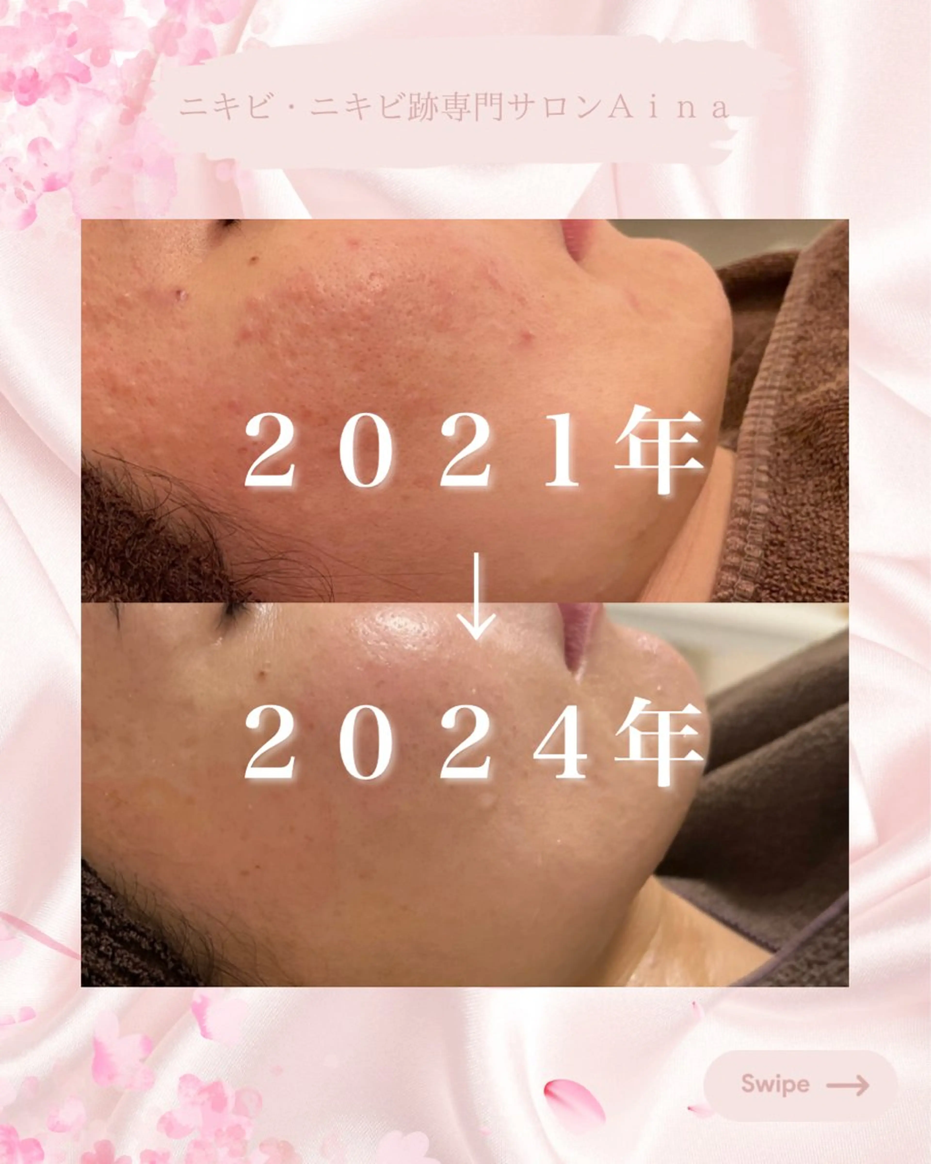 エステ リラク ニキビ跡専門サロン Ainaのエステ・リラクイメージ