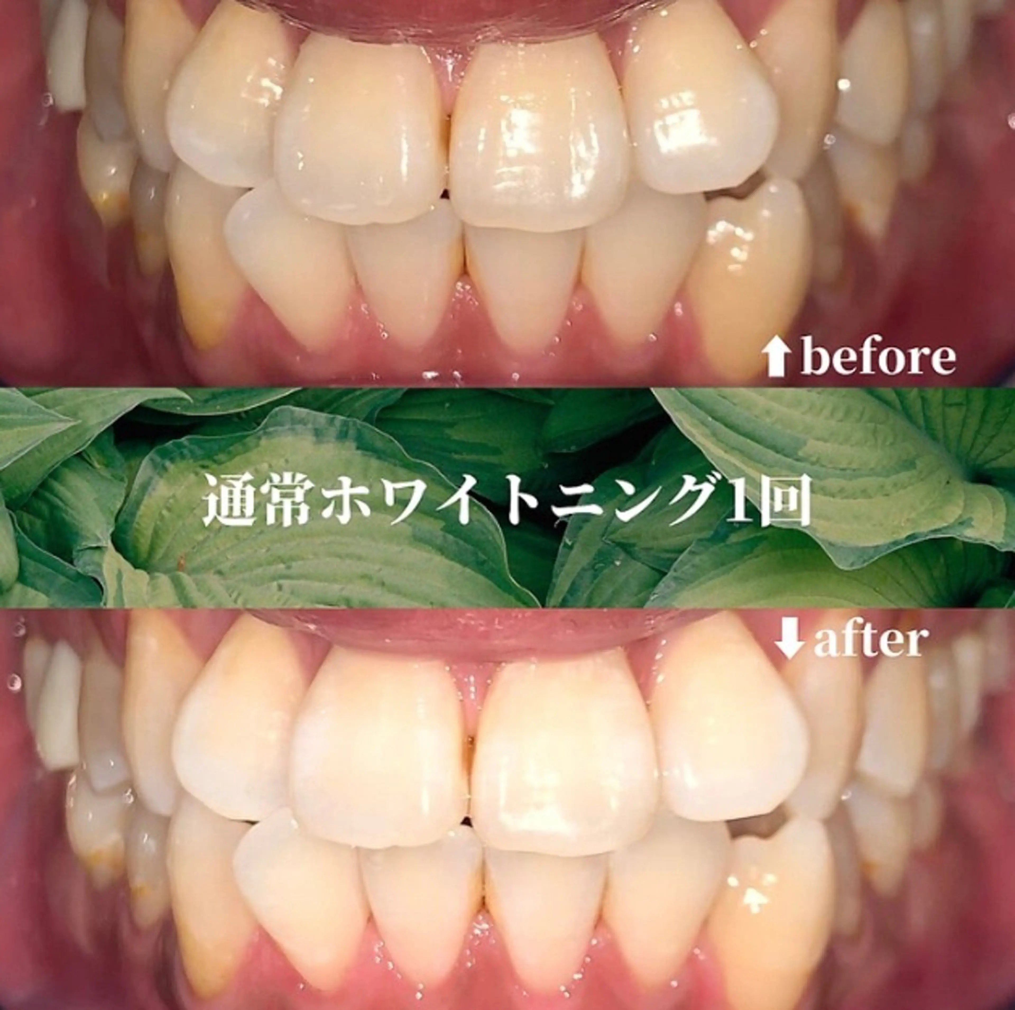 futaba ホワイトニング/天神のエステ・リラクイメージ