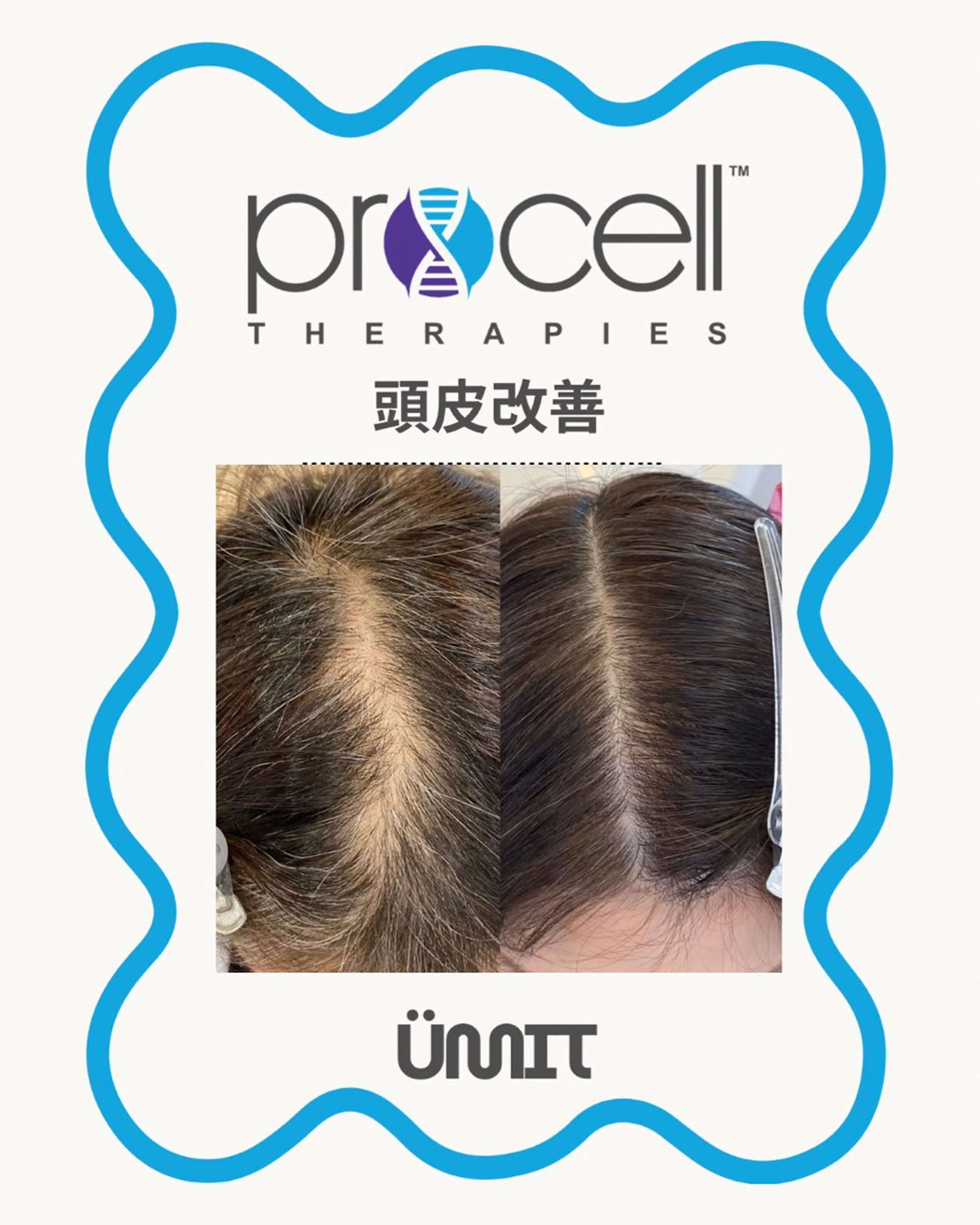 ヘッドスパ Ümit（ユミト） プロセルセラピーズのヘアスタイル