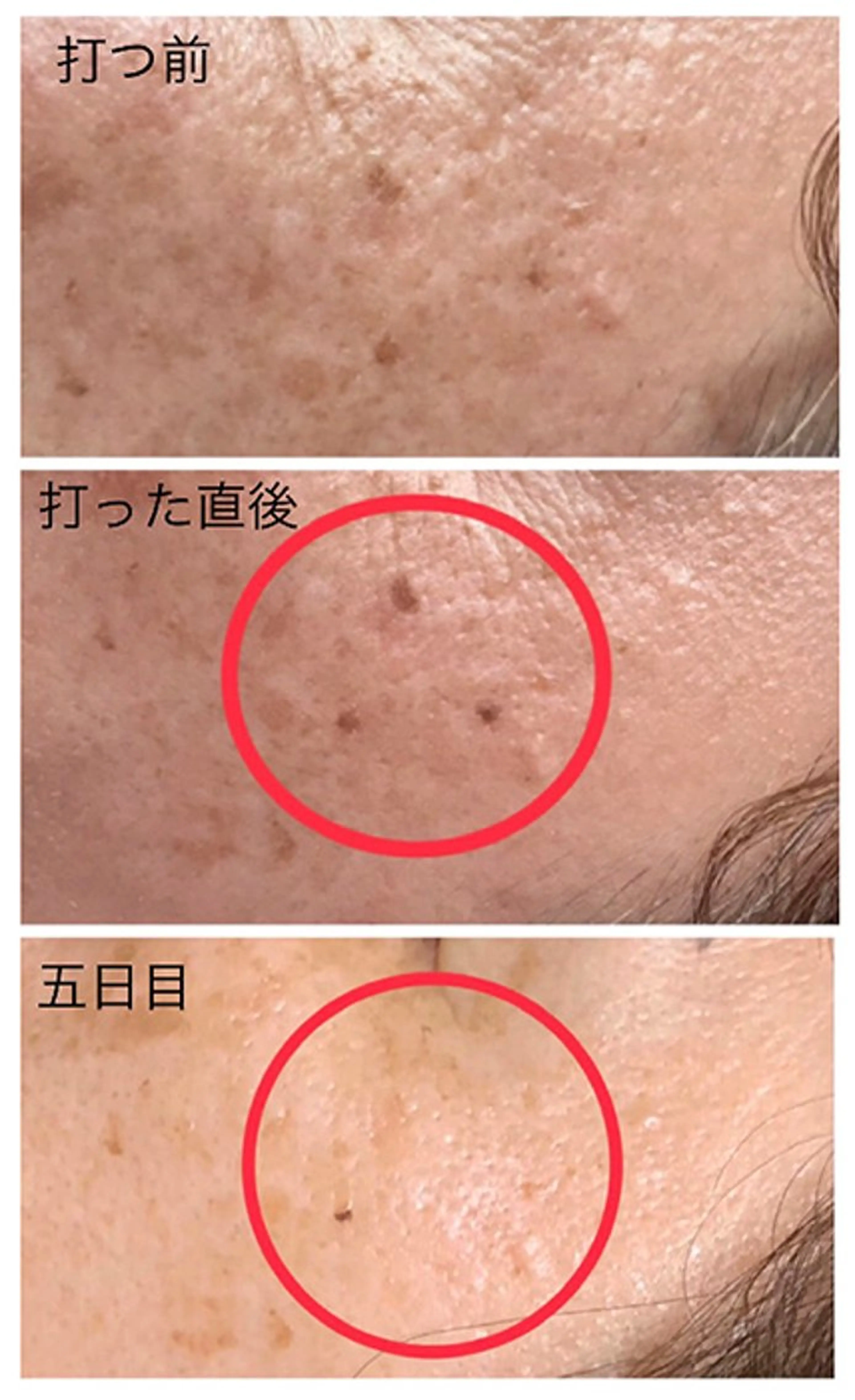 エステ LiZA エステティックサロンのエステ・リラクイメージ