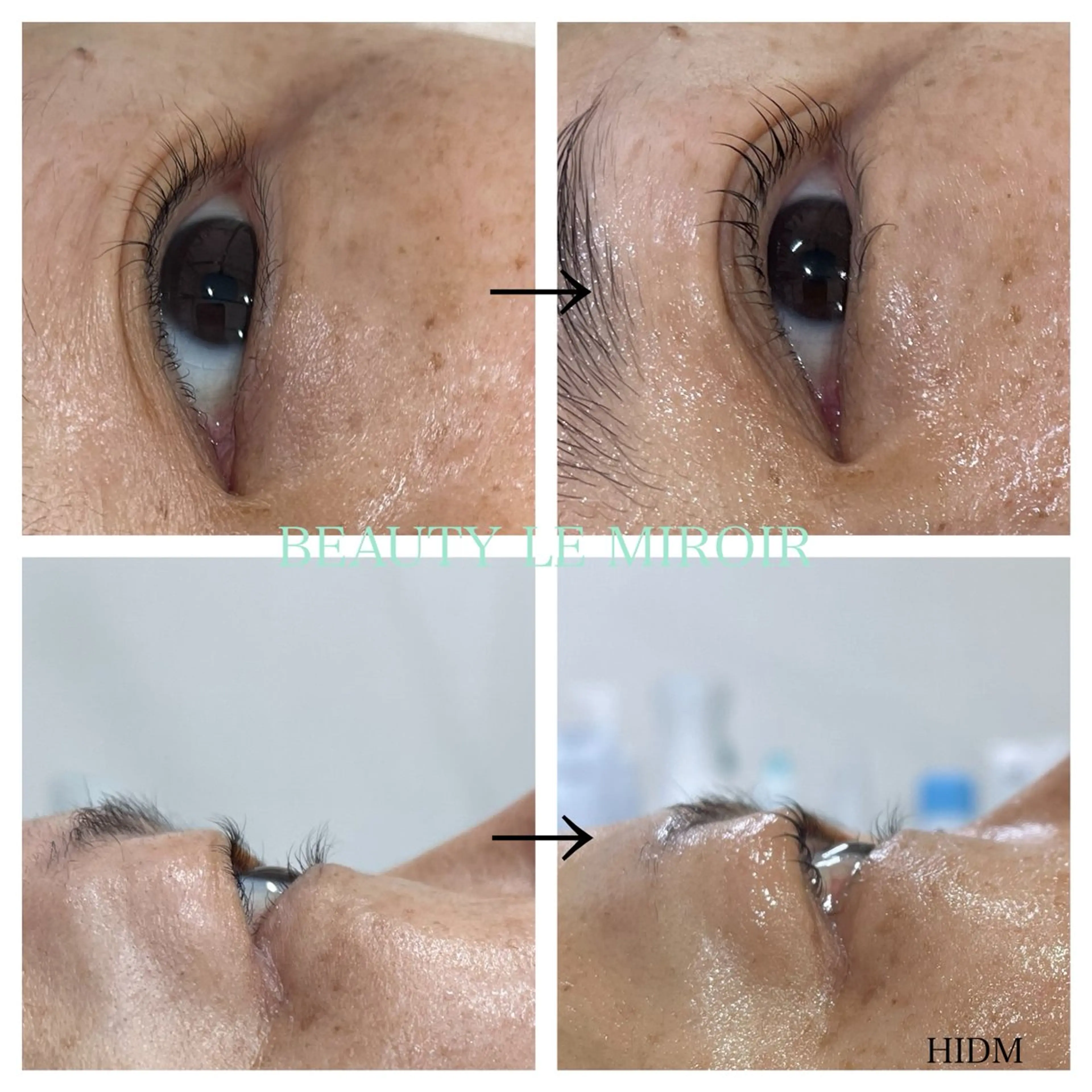 マツエク・マツパ ビューティー ミロワールのエステ・リラクイメージ