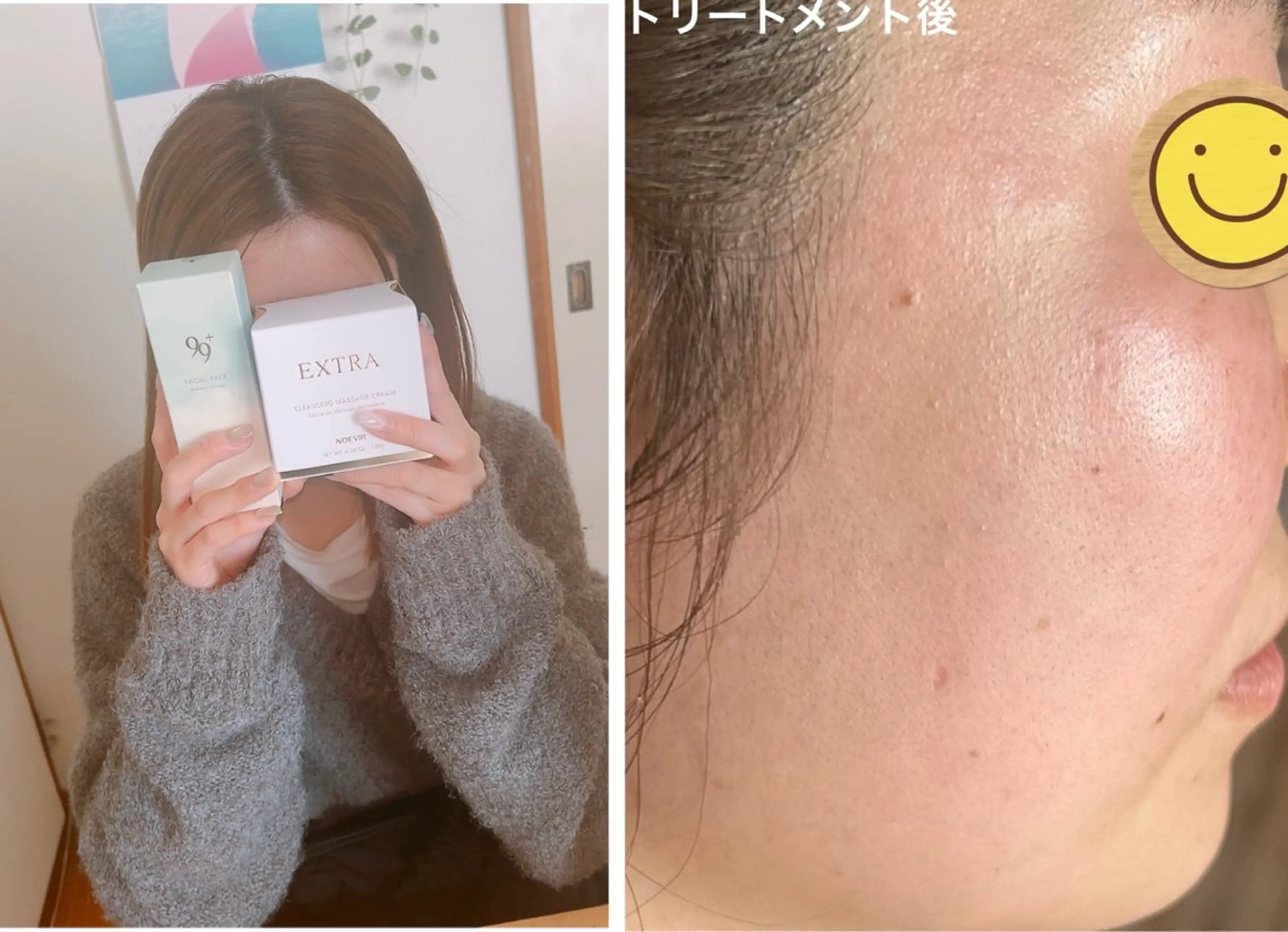 ノエビアビューティースタジオセレンディピティ所属・ノエビアビューティー セレンディピティのエステ・リラクイメージ