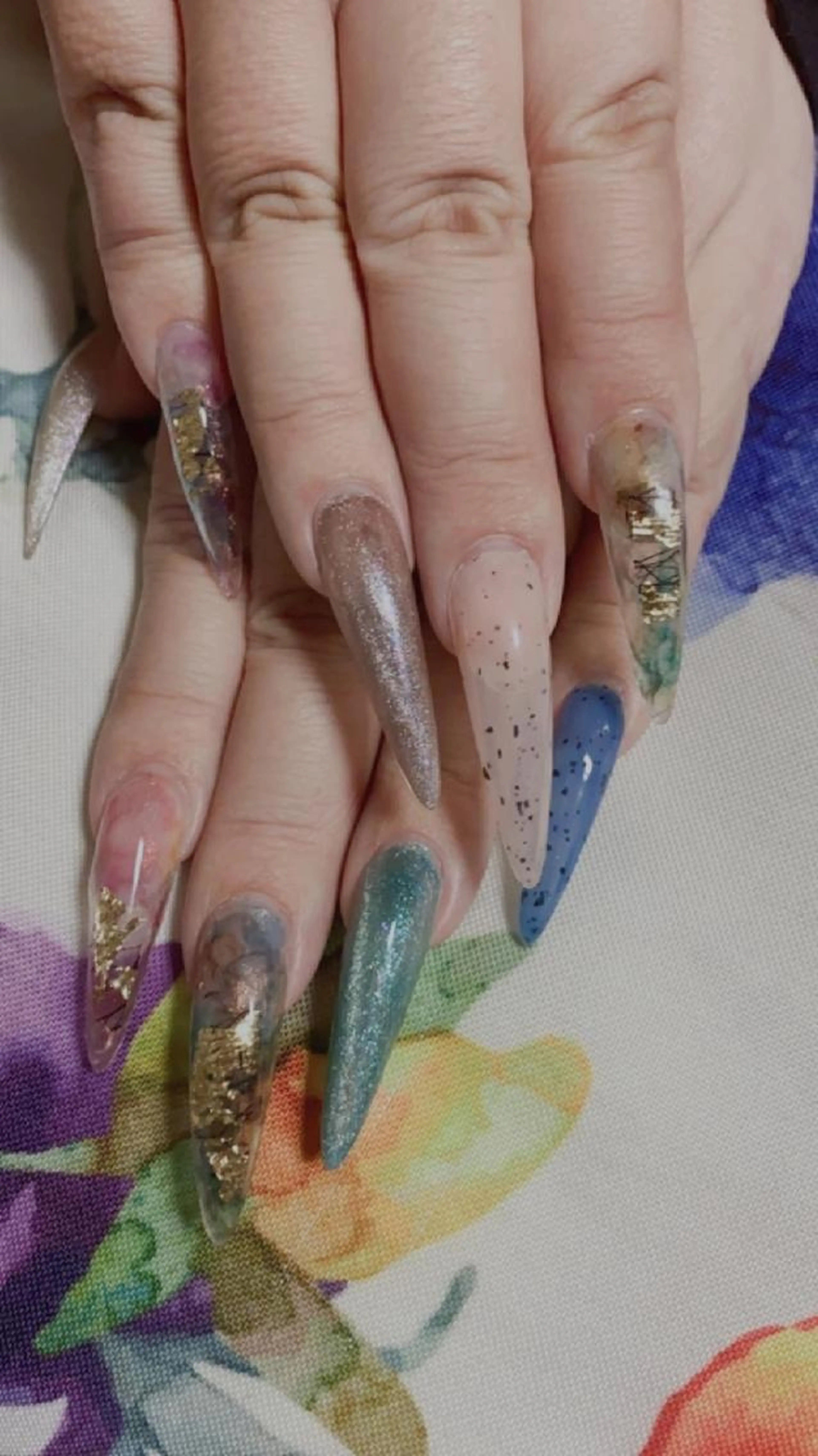 GEL-XスカルプコースXXL　オフなしの写真