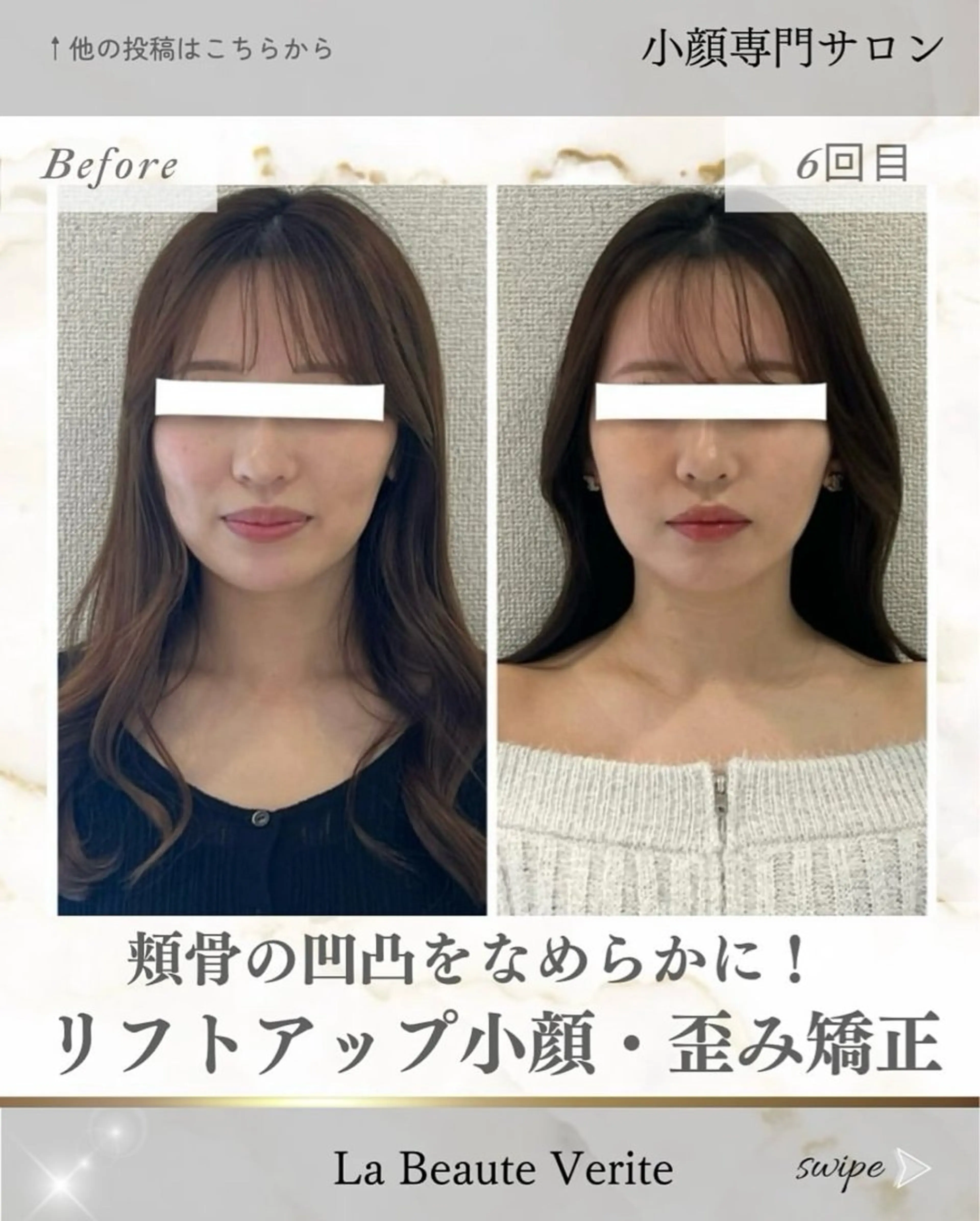 歪みに特化!痛くない小顔矯正の写真