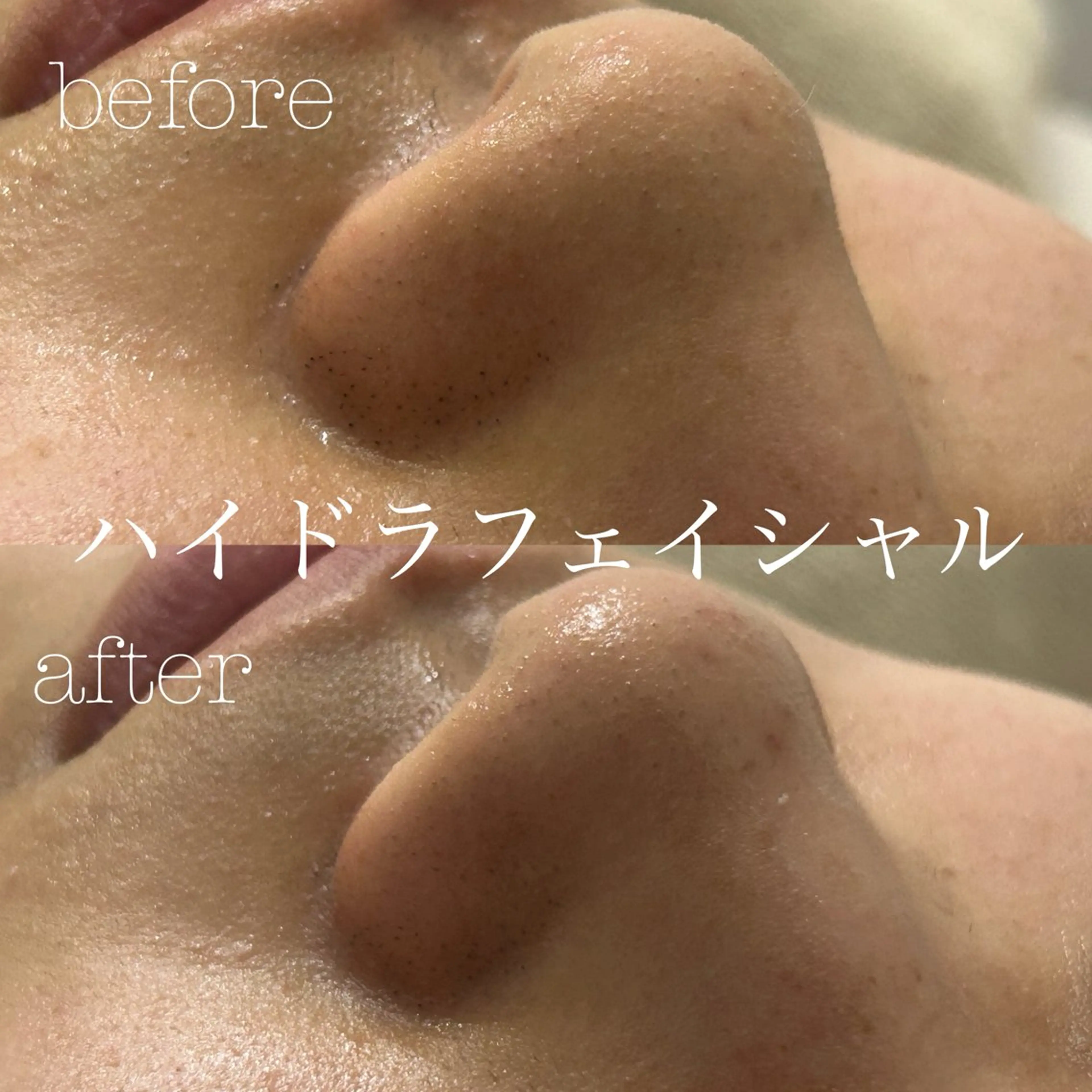 エステ フェイシャルサロン CHIARA 荒田のエステ・リラクイメージ