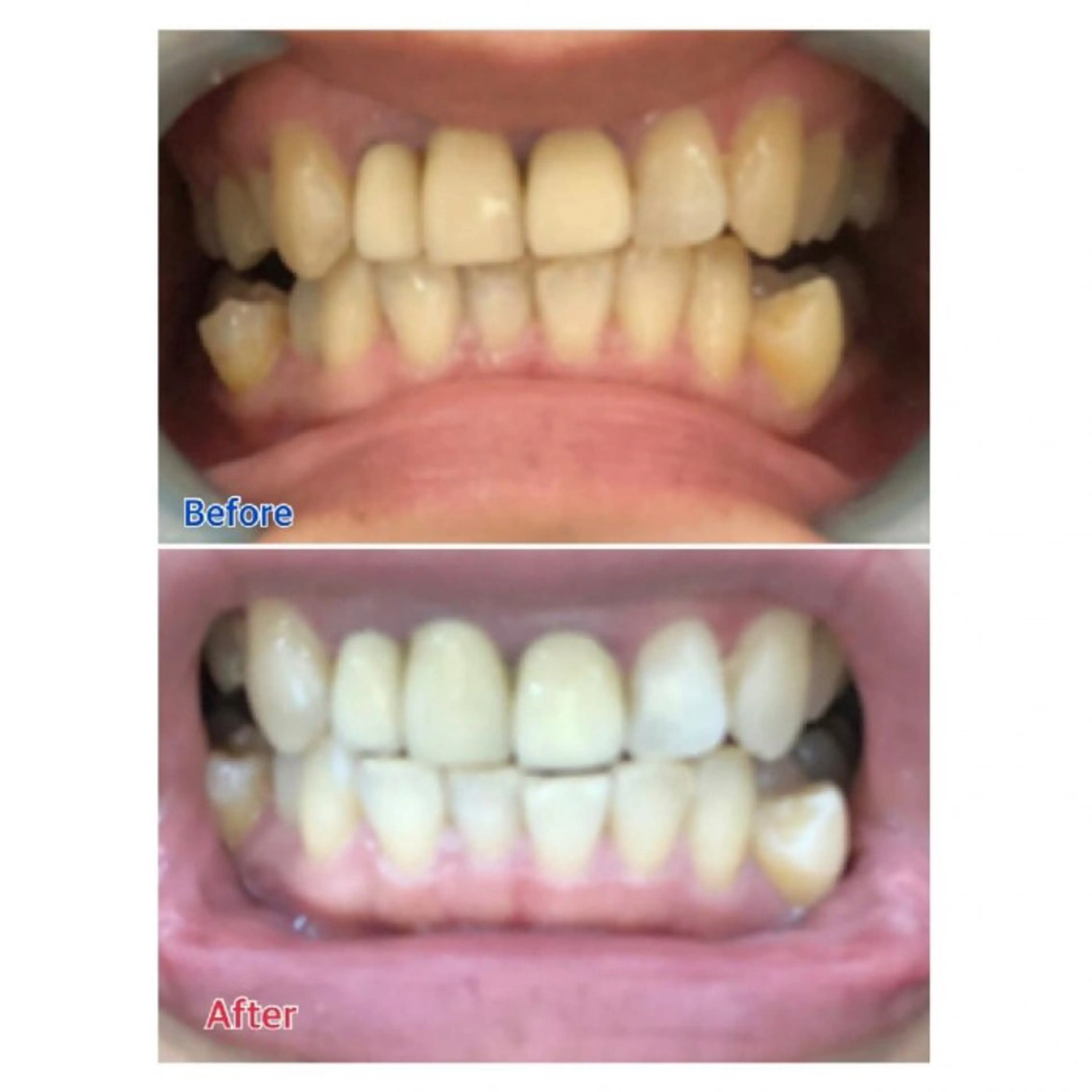 M渋谷店所属・Ｍ渋谷 ホワイトニングのその他イメージ