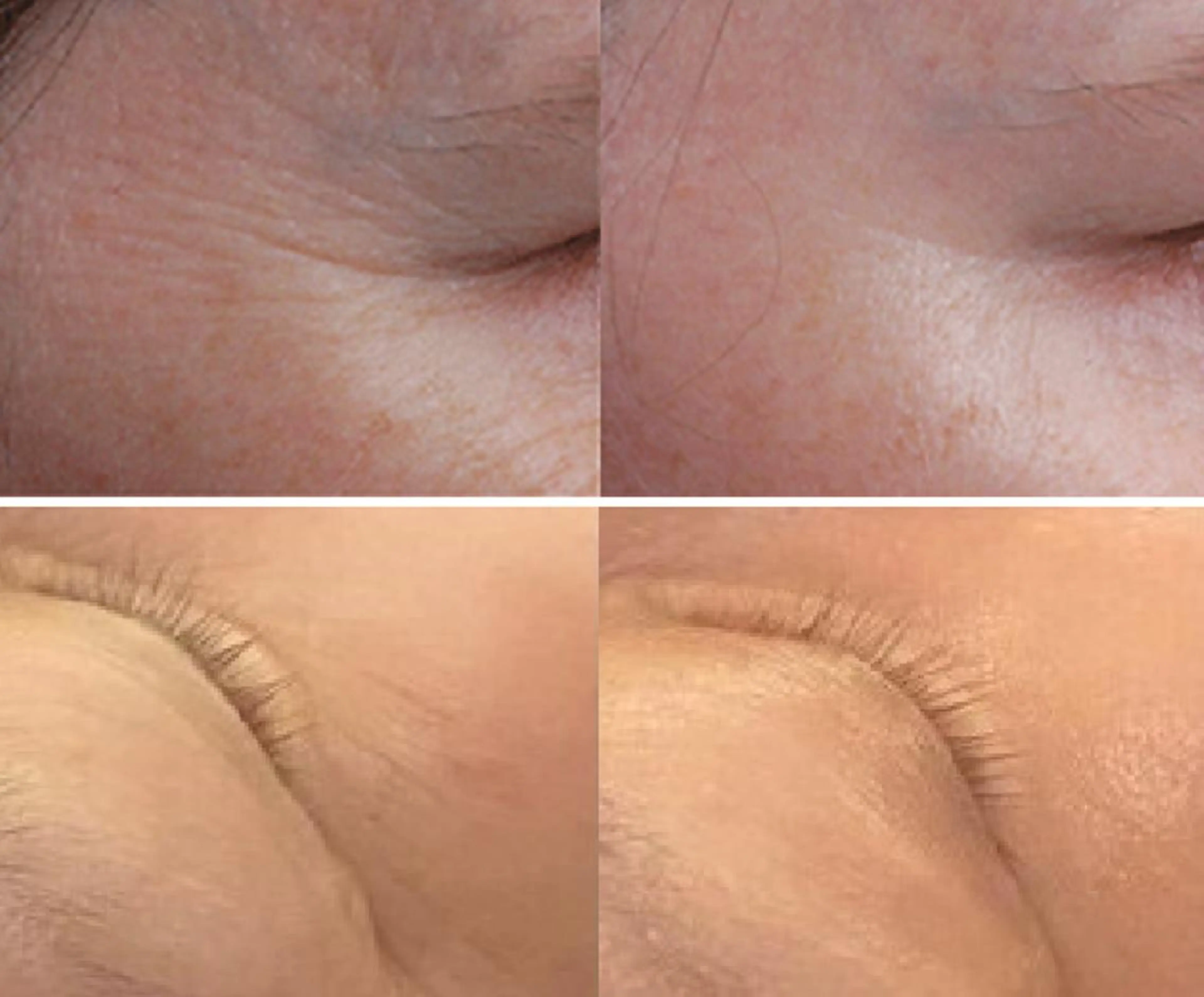 脱毛 全身脱毛&VIO脱毛 紹介率№1♪リナ♪のエステ・リラクイメージ