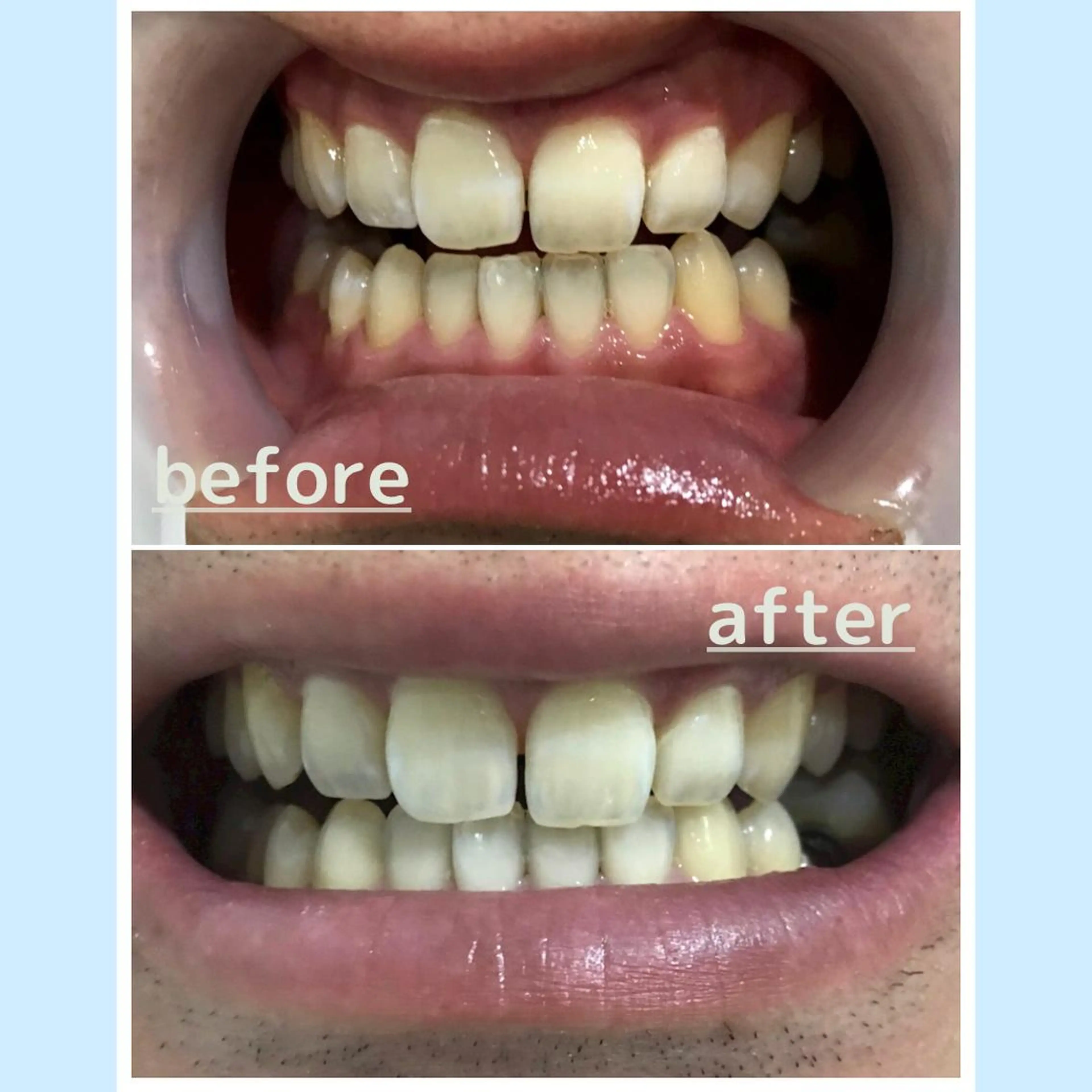 メンズ お手軽ホワイトニングsalon mina所属・武元 奈津美のその他イメージ