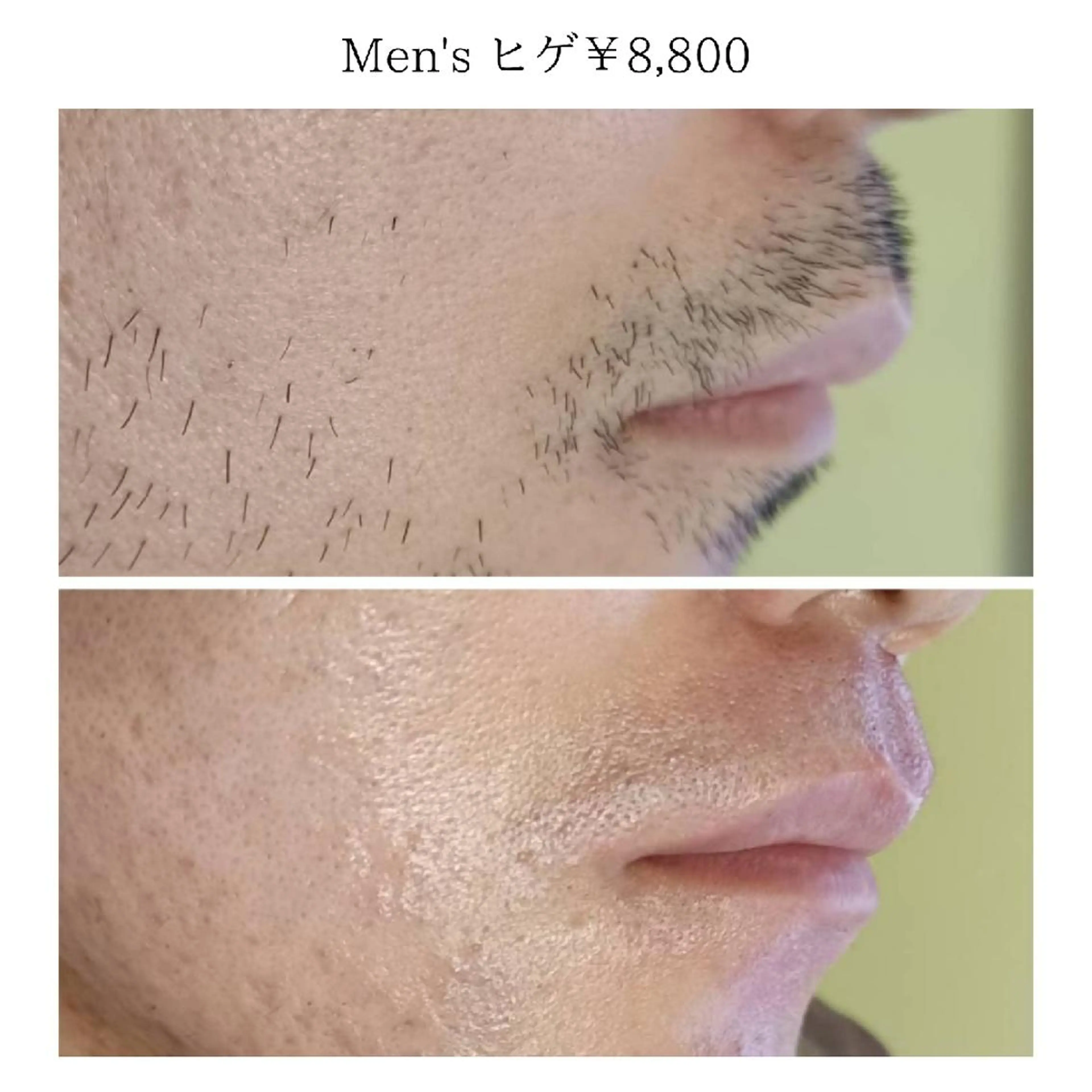 メンズ Lutella所属・ワックス脱毛専門店 Lutellaのエステ・リラクイメージ