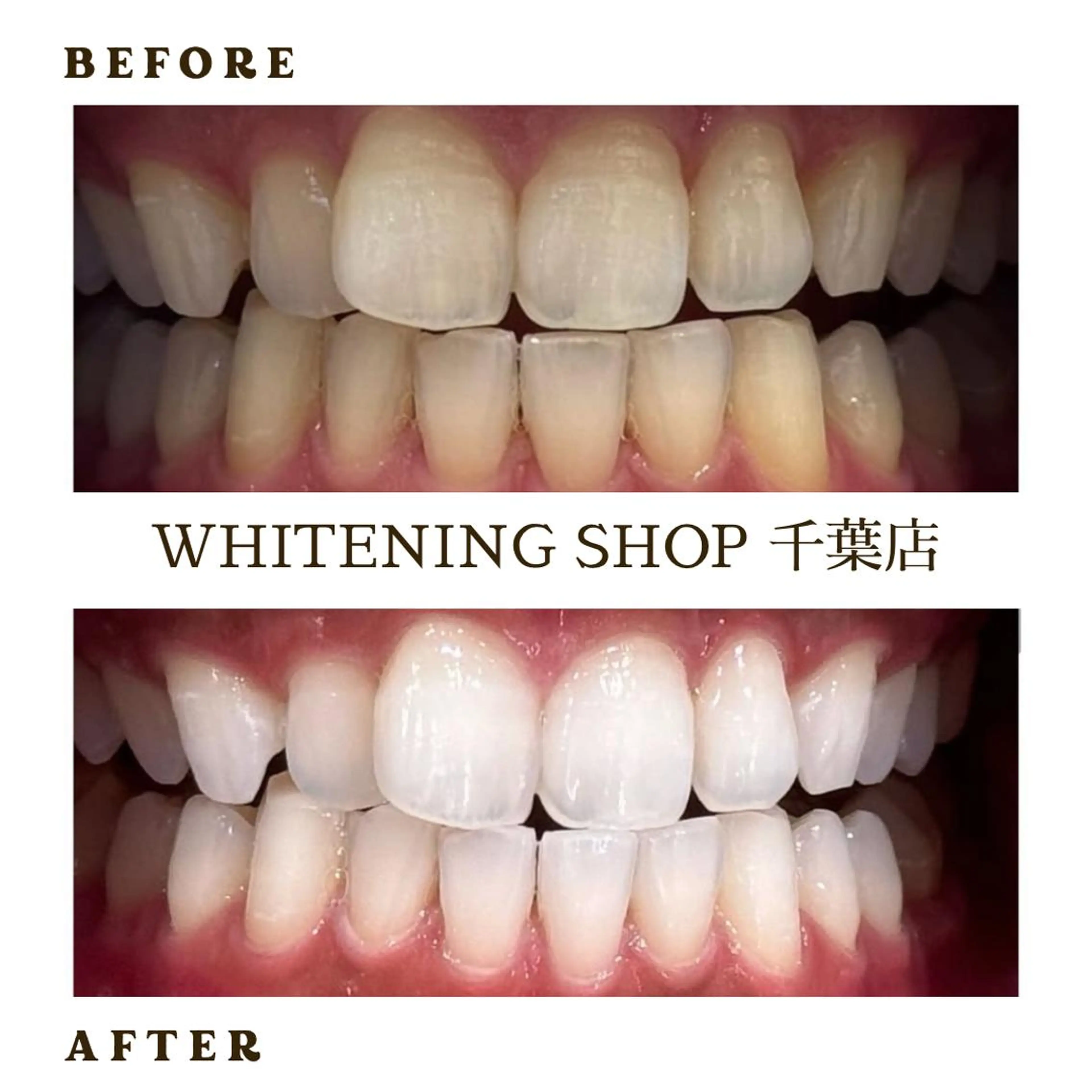 メンズ エステ ホワイトニング ショップ千葉店のその他イメージ