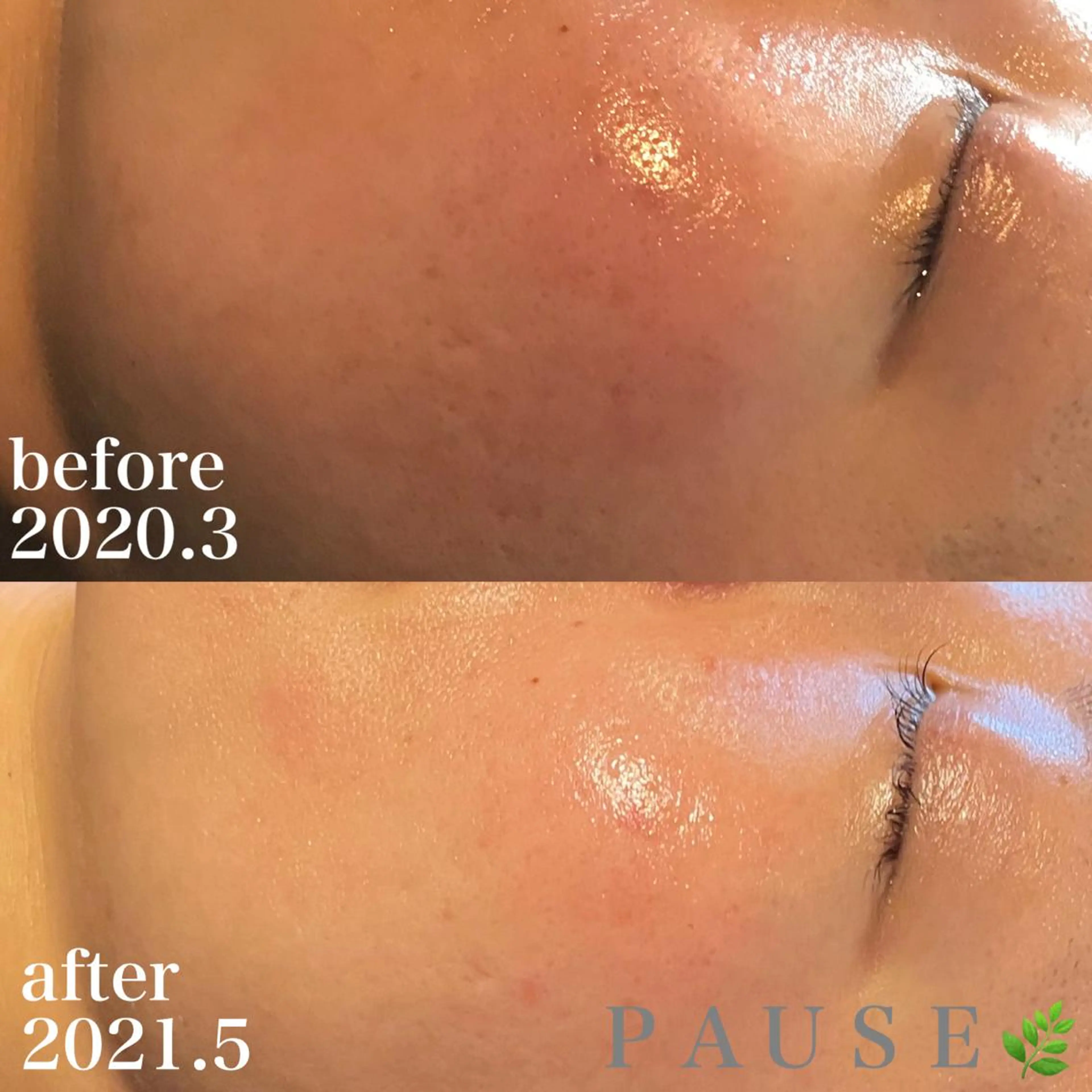 エステ 浜野 恵美のエステ・リラクイメージ