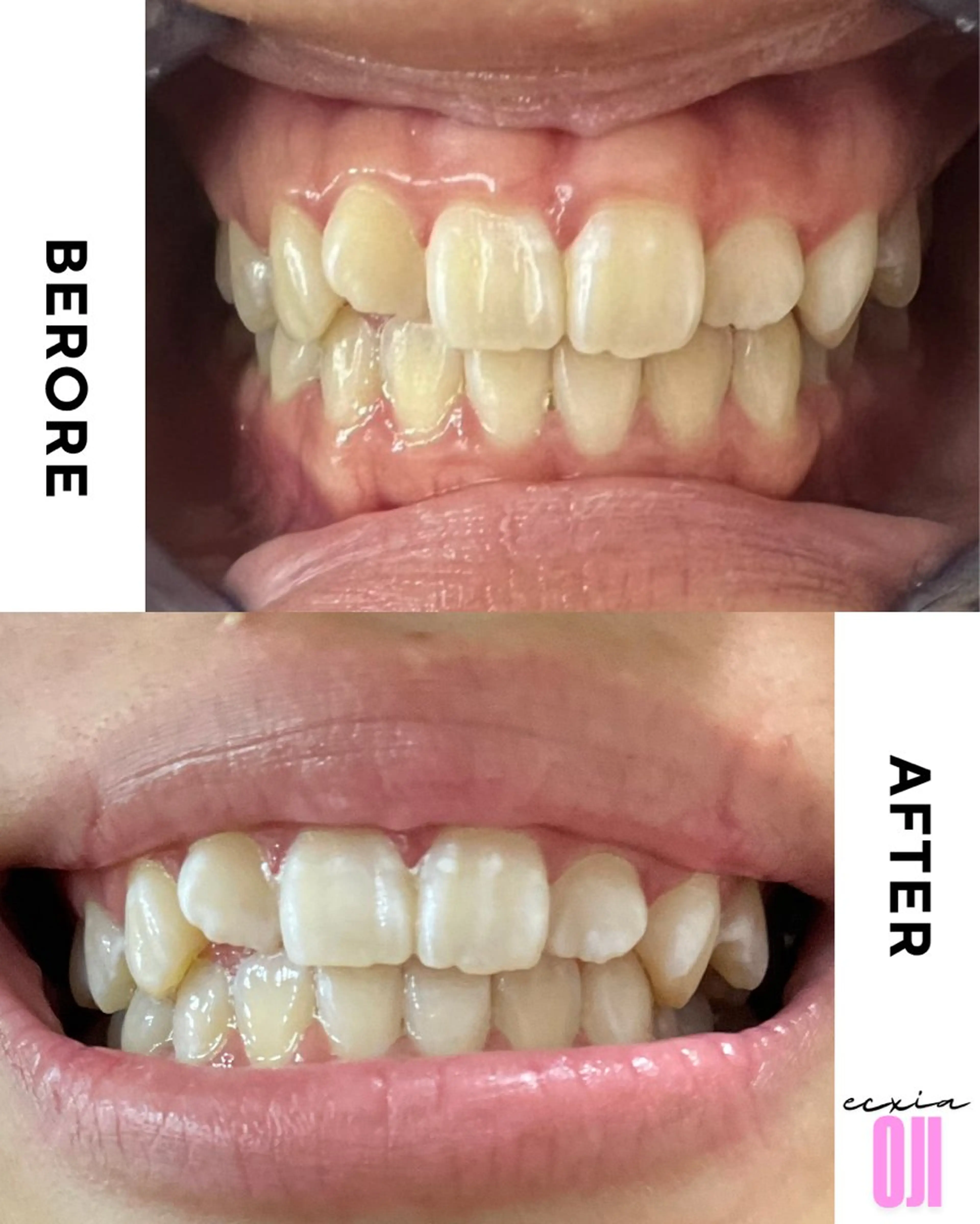 その他 セルフホワイトニングサロン  エクシアホワイト 王寺店所属・エクシア王寺 NISHIKAWAのその他イメージ