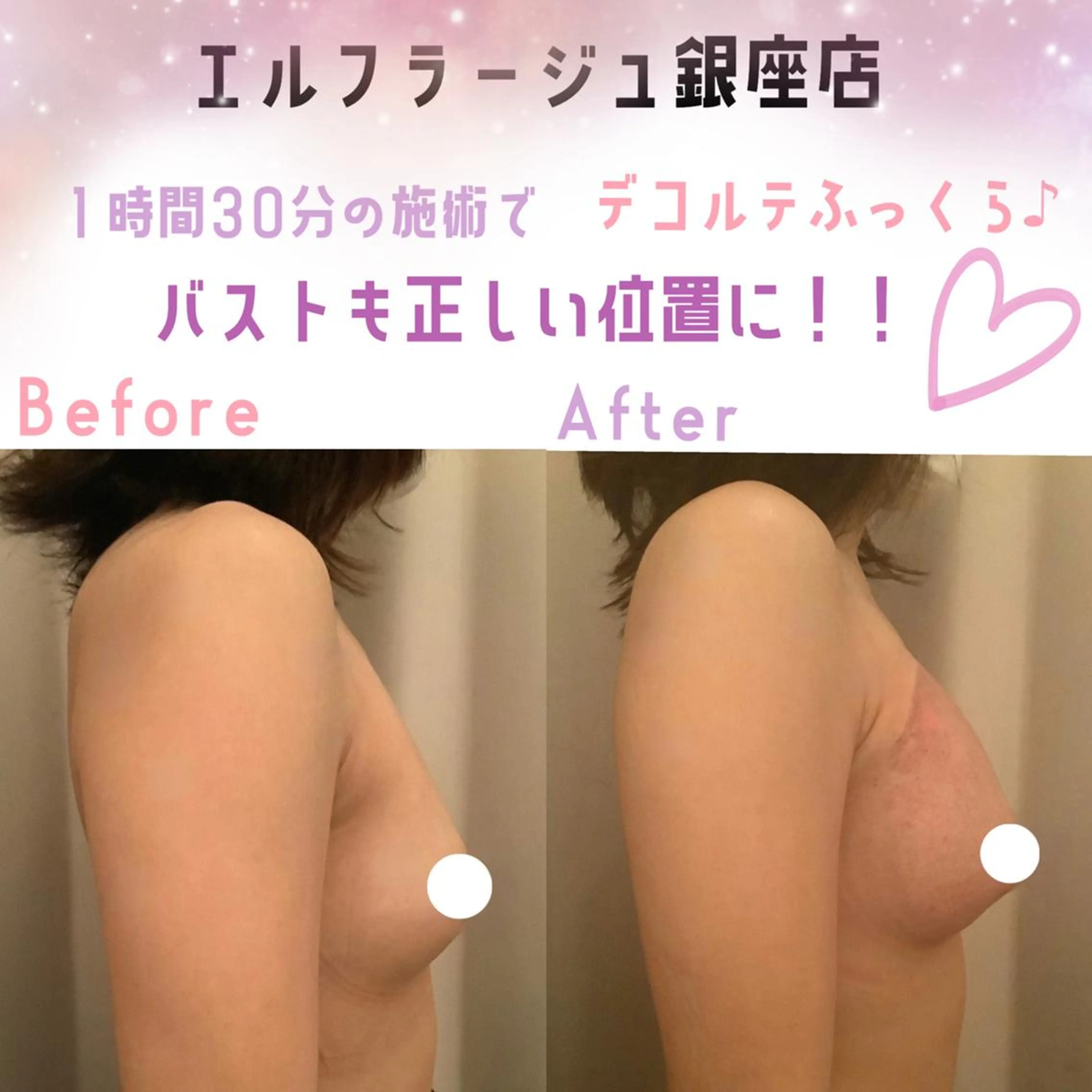 エルフラージュ 銀座店のエステ・リラクイメージ