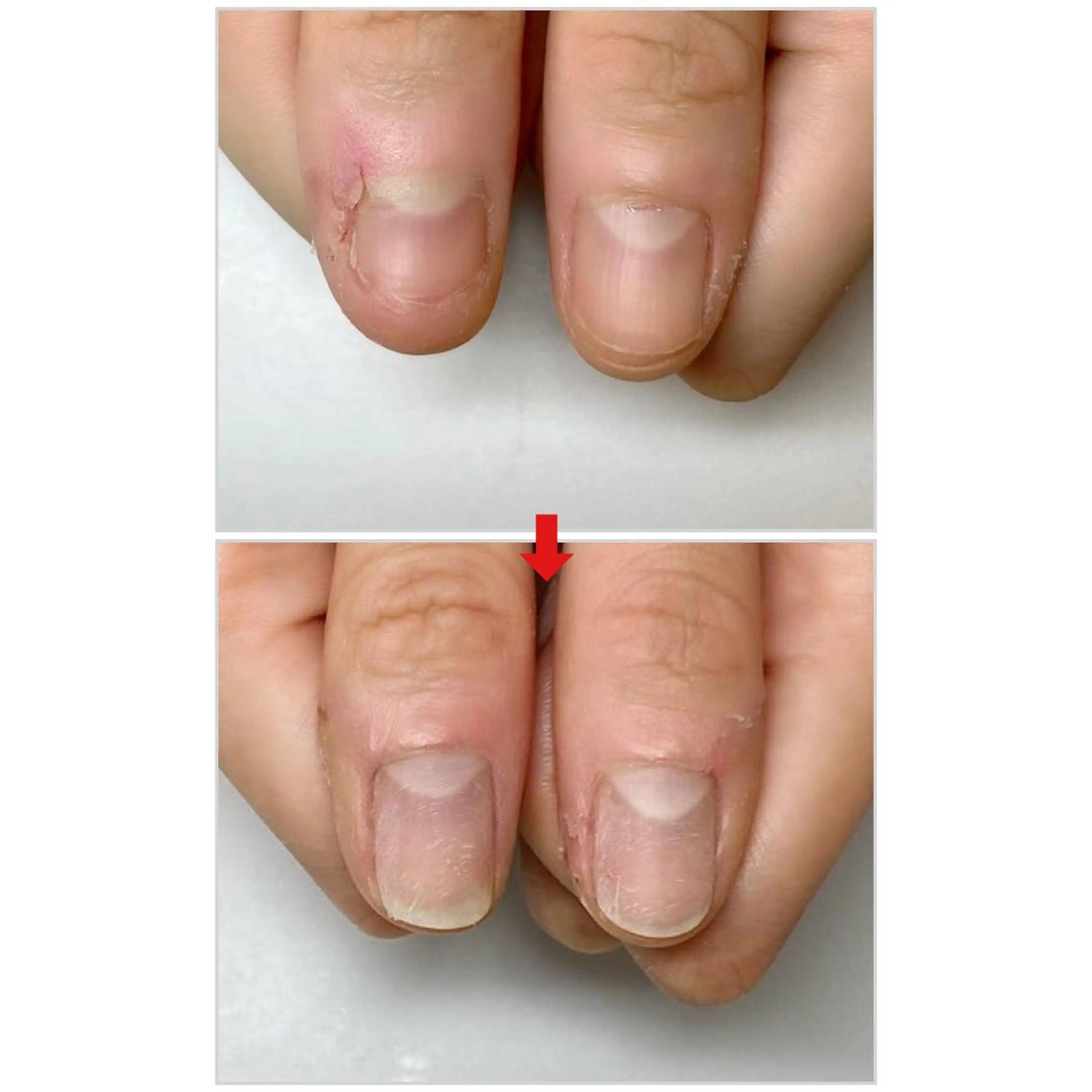 ネイル ネイルサロンアリューム所属・ネイルサロン アリュームのネイルデザイン