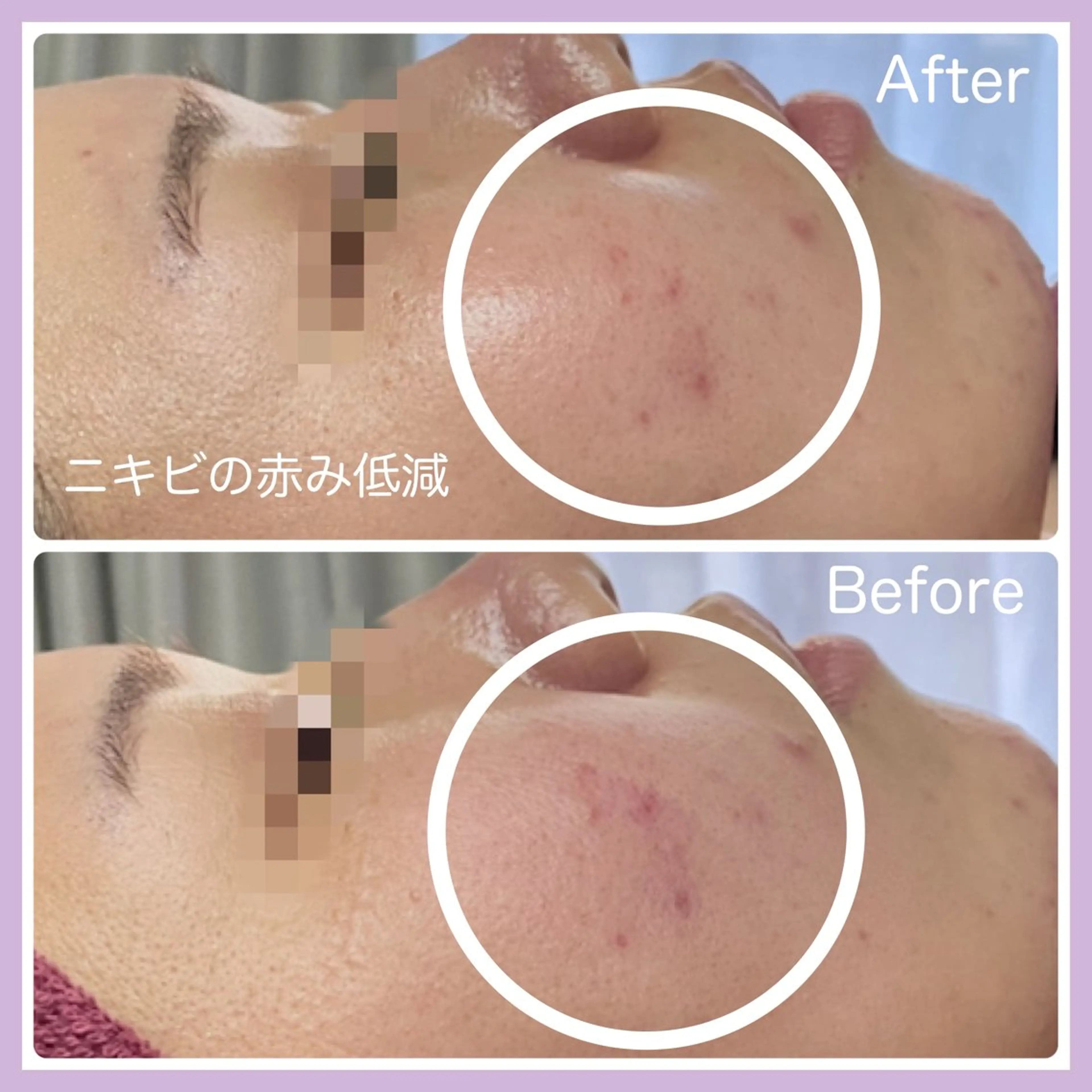 【代謝×免疫UP】お肌と身体のオールハンド専門店estheya sign所属・オールハンド専門店 【リンパ×ヘッド】のエステ・リラクイメージ