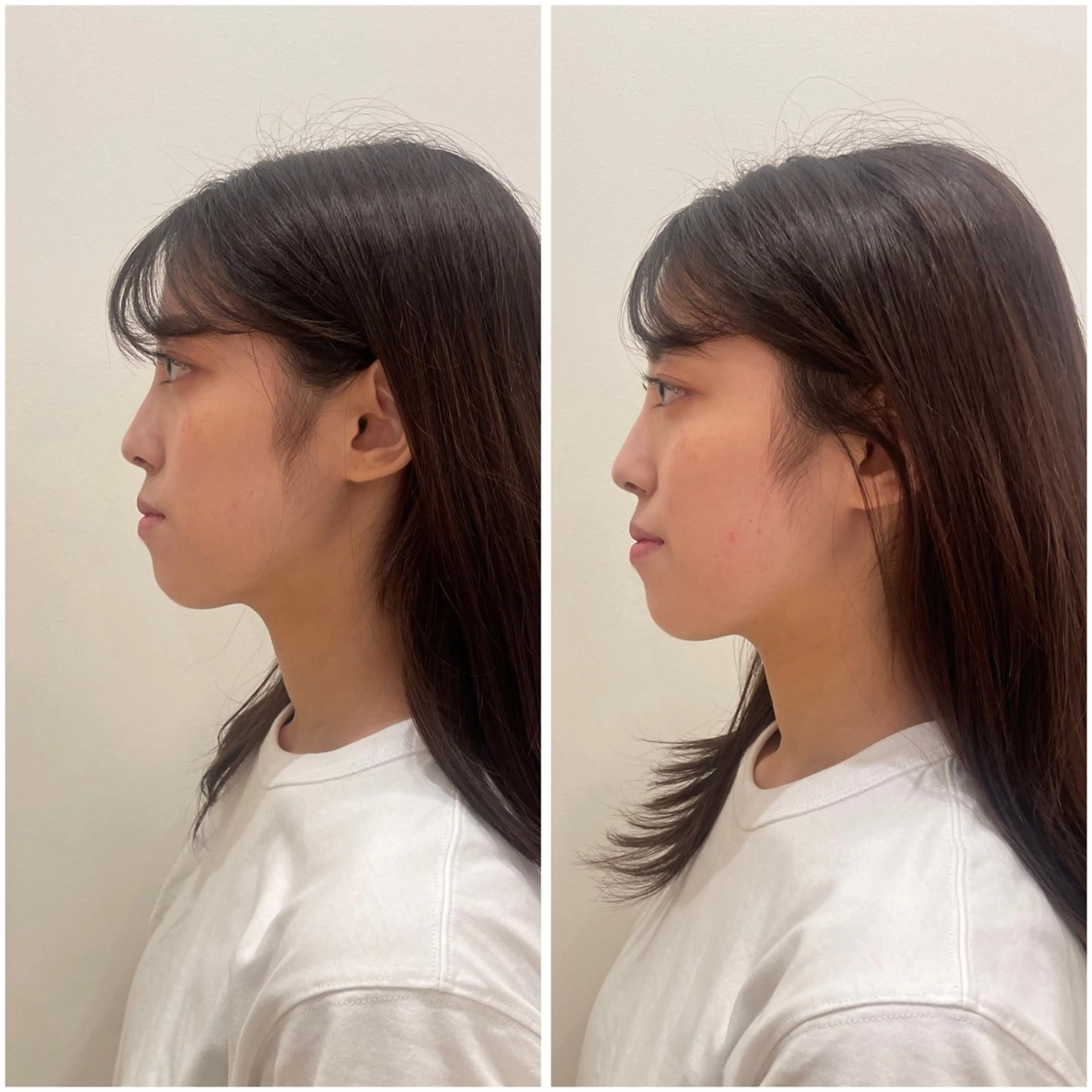 美容鍼サロンメゾンブランシェ所属・🌸美容鍼サロン🌸 メゾンブランシェ🌈のエステ・リラクイメージ