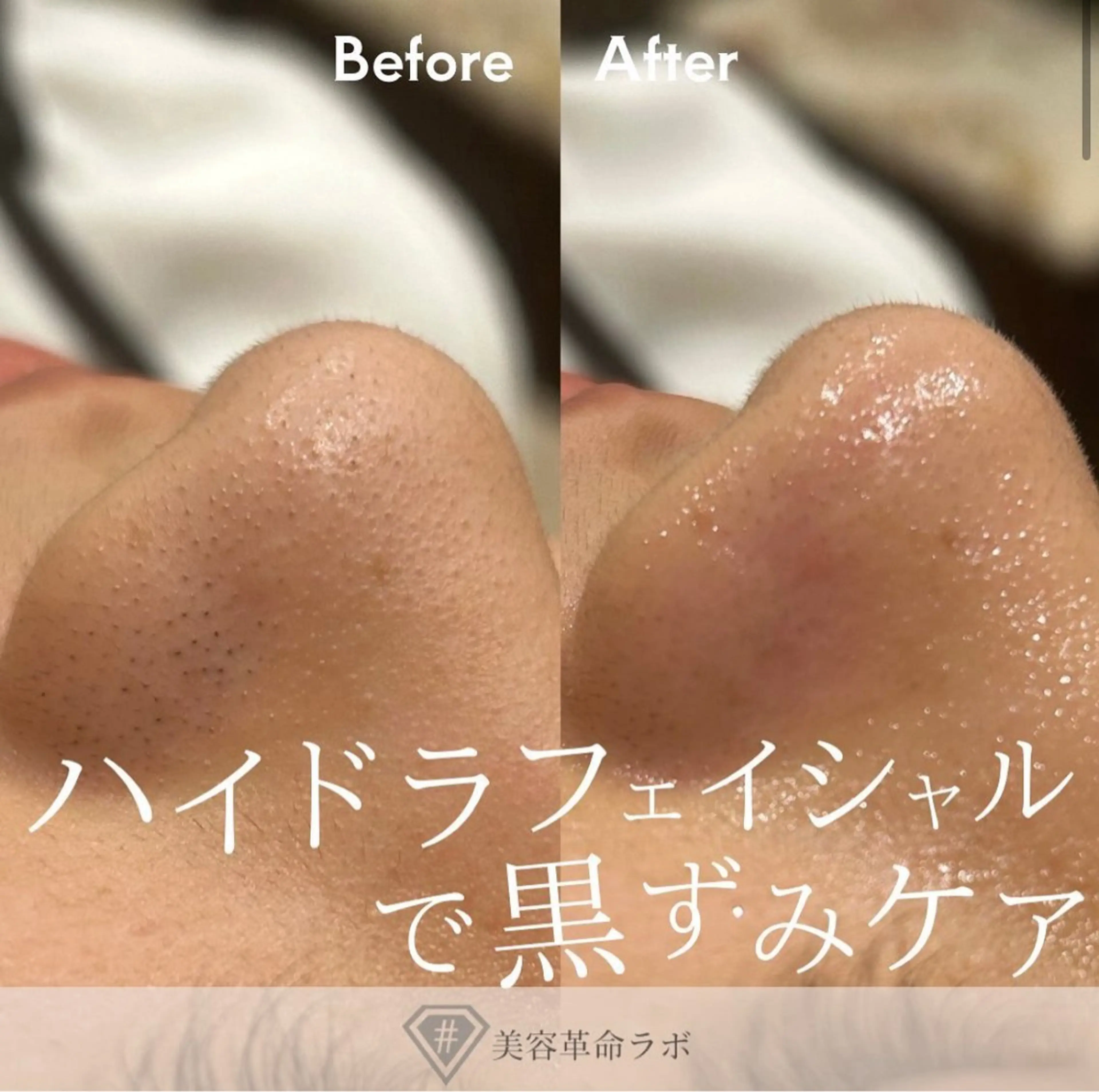 # fu♡のエステ・リラクイメージ