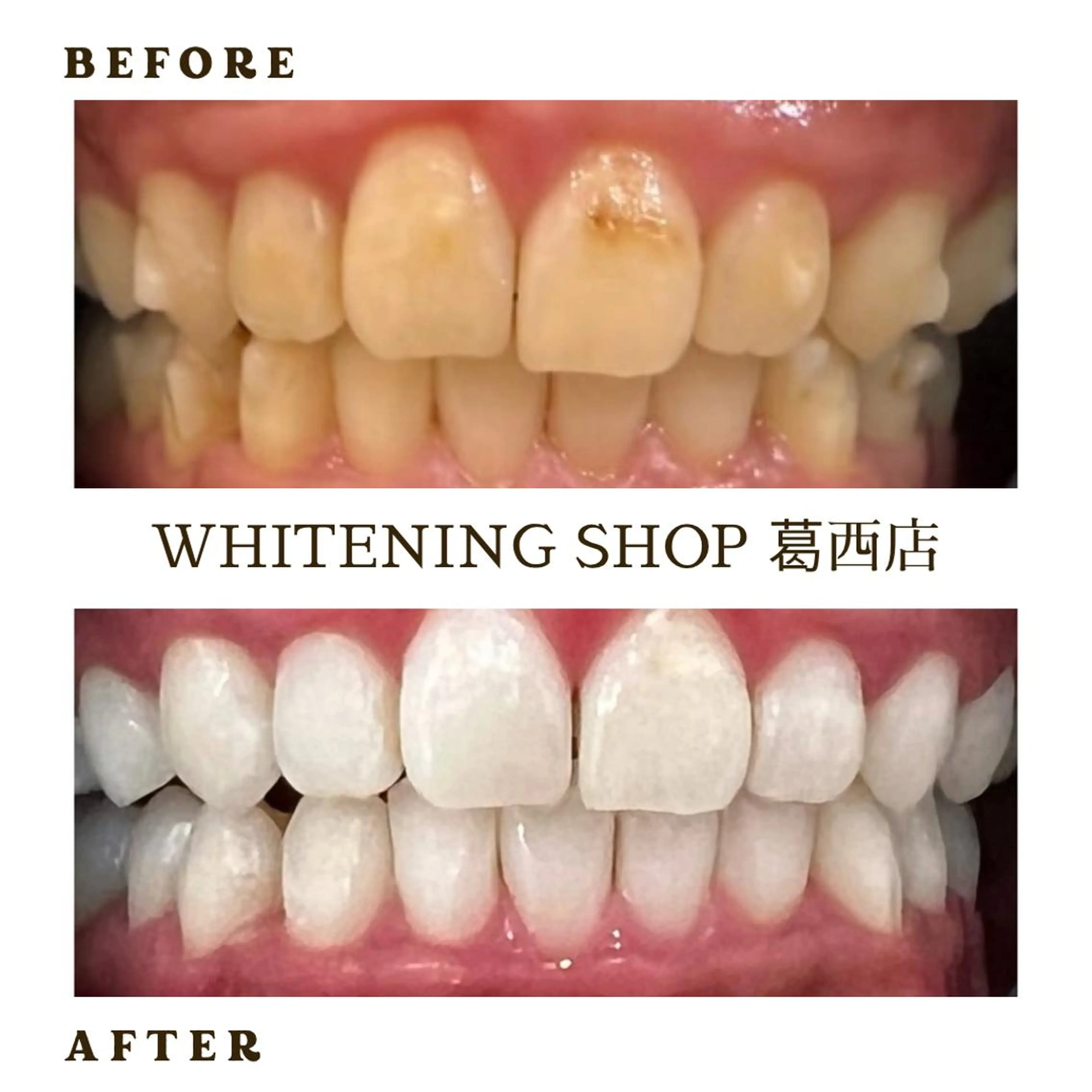 メンズ その他 ホワイトニング ショップ葛西店のその他イメージ