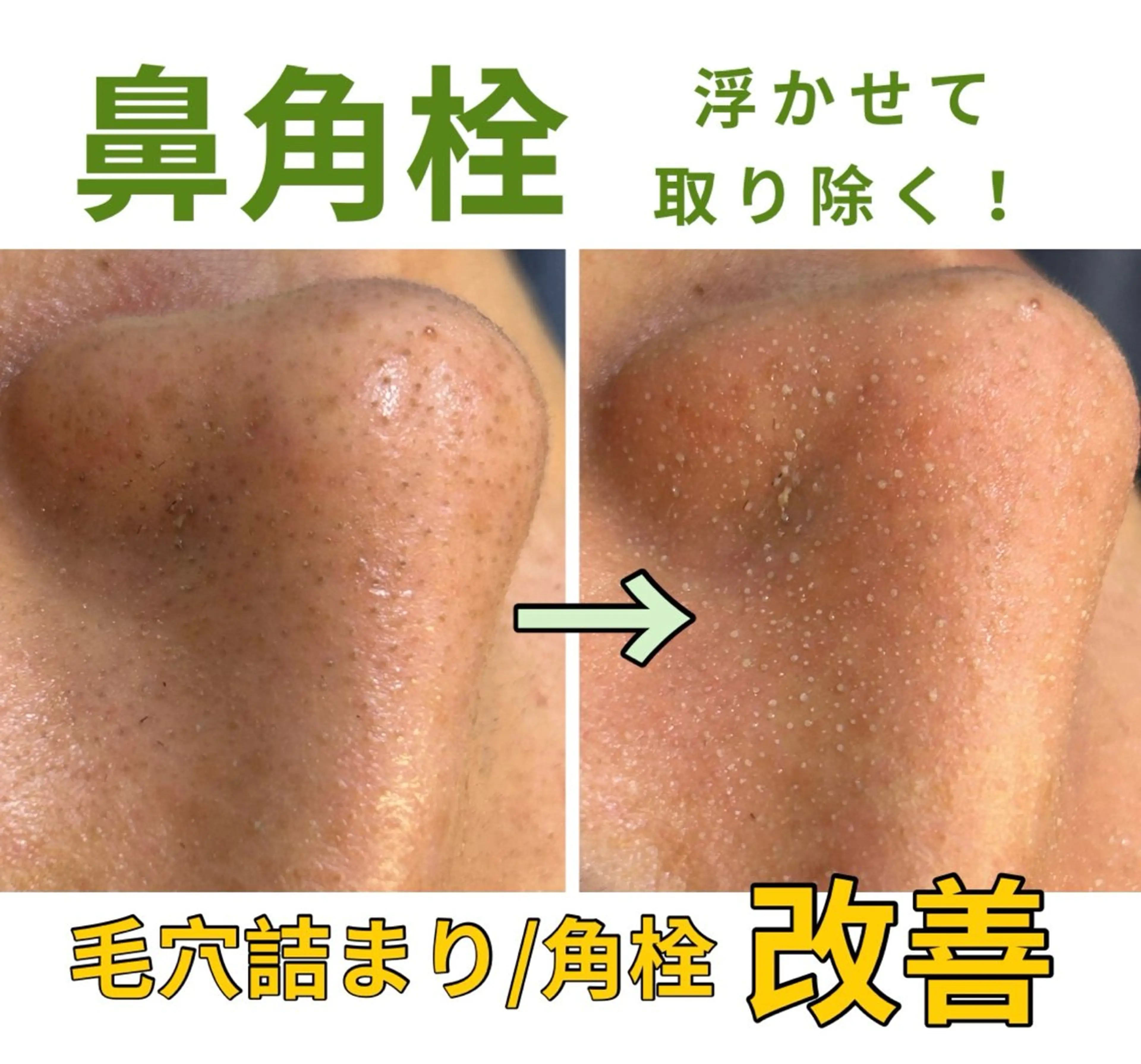 leolo武蔵浦和 肌質改善＆脱毛のエステ・リラクイメージ