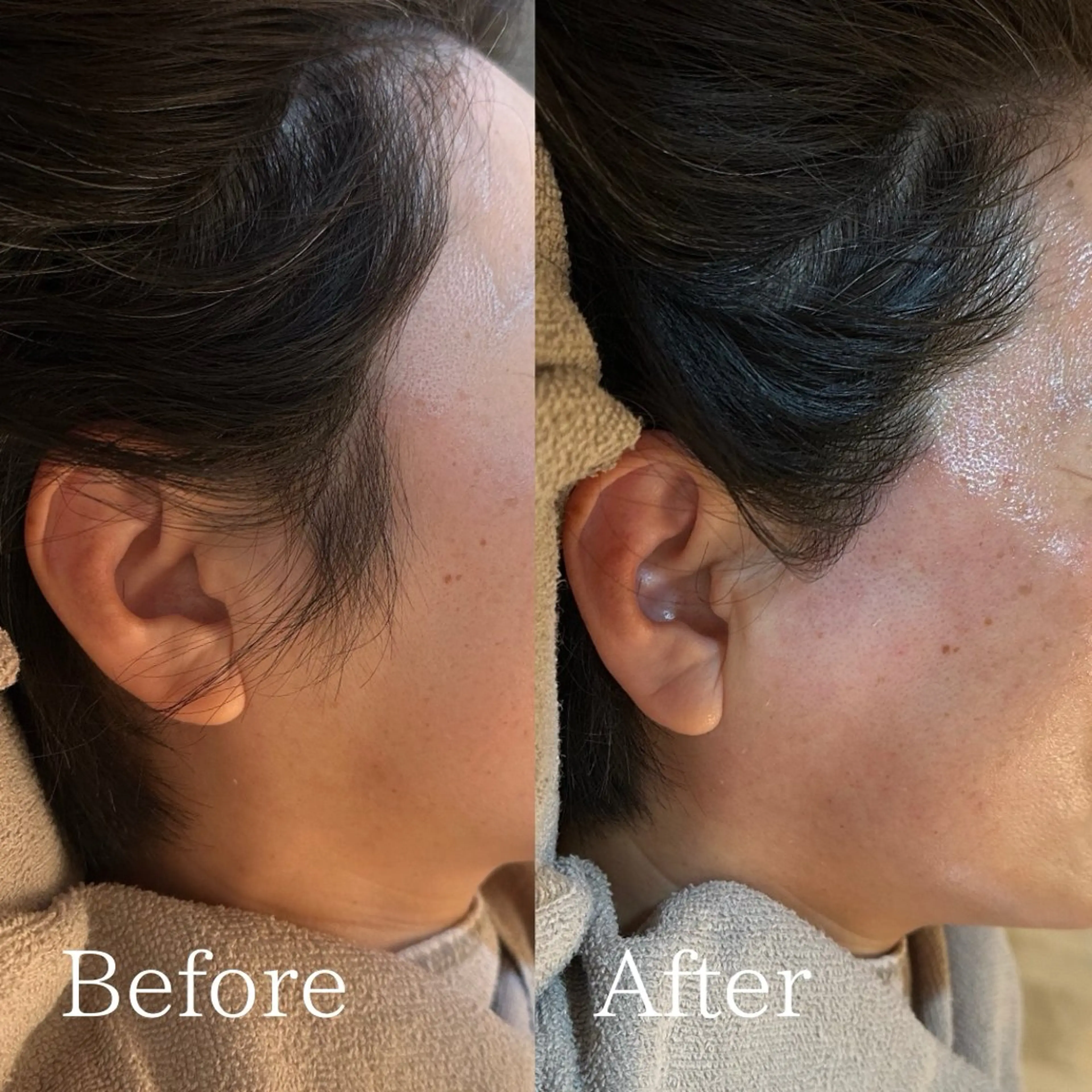 プライベート脱毛サロン　Arum所属・脱毛サロン Arumのエステ・リラクイメージ