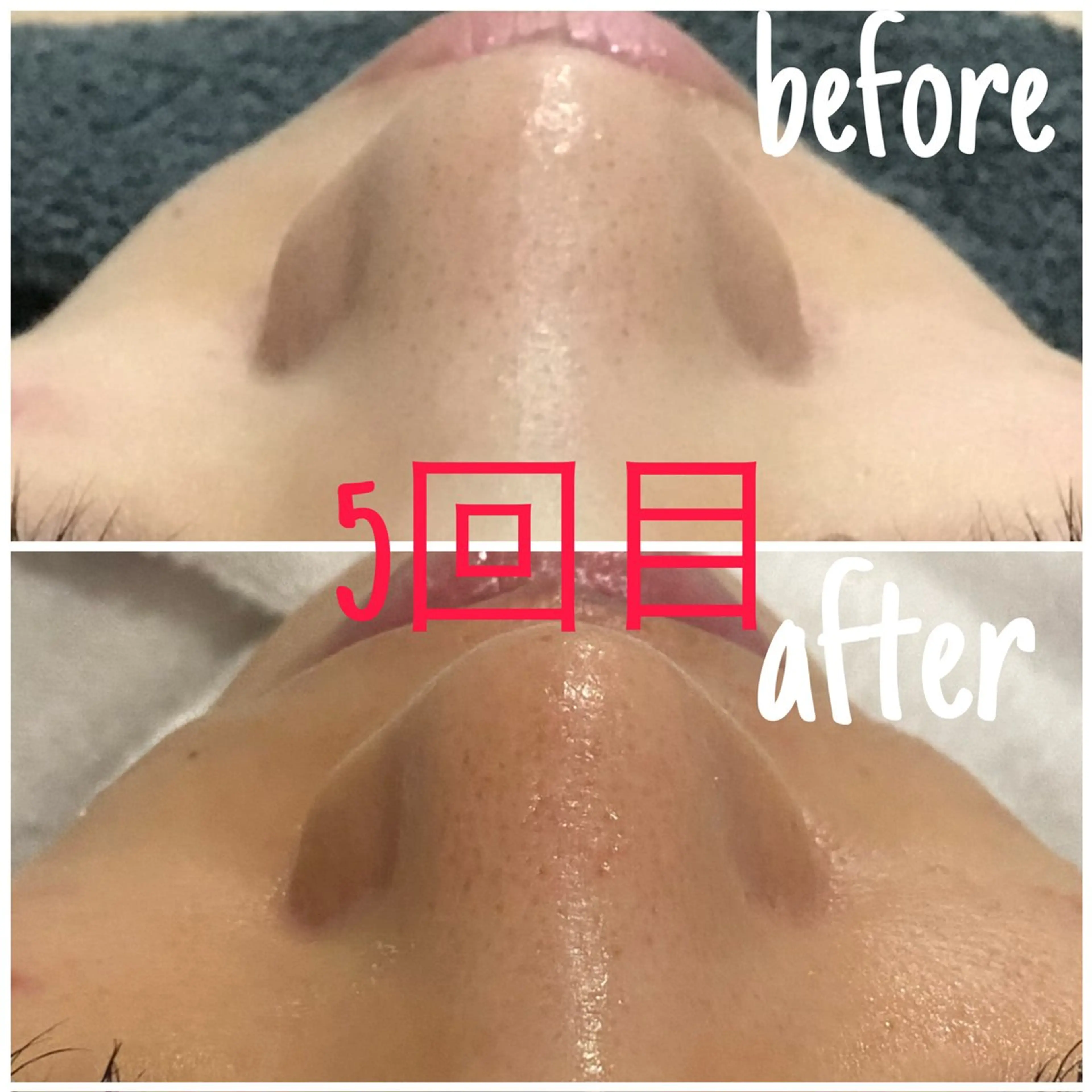 アルカンジュ~archange~所属・痩身/毛穴洗浄/脱毛 アルカンジュのエステ・リラクイメージ