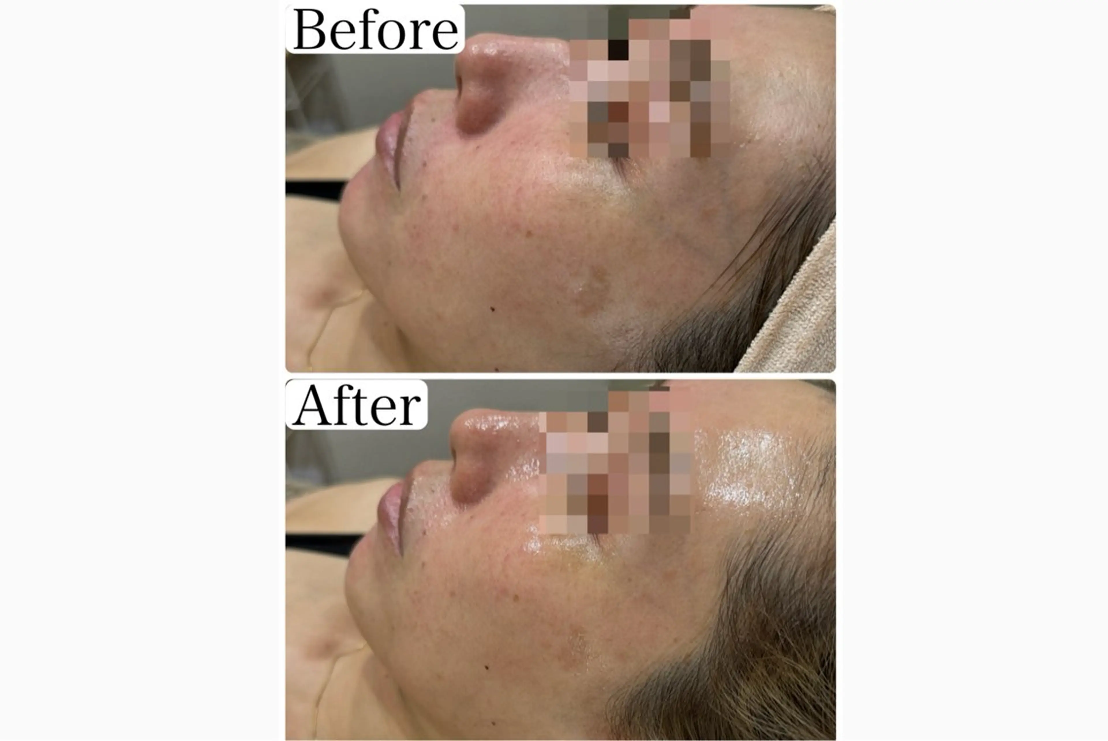 エステ 脱毛&フェイシャル 専門店muro.のエステ・リラクイメージ