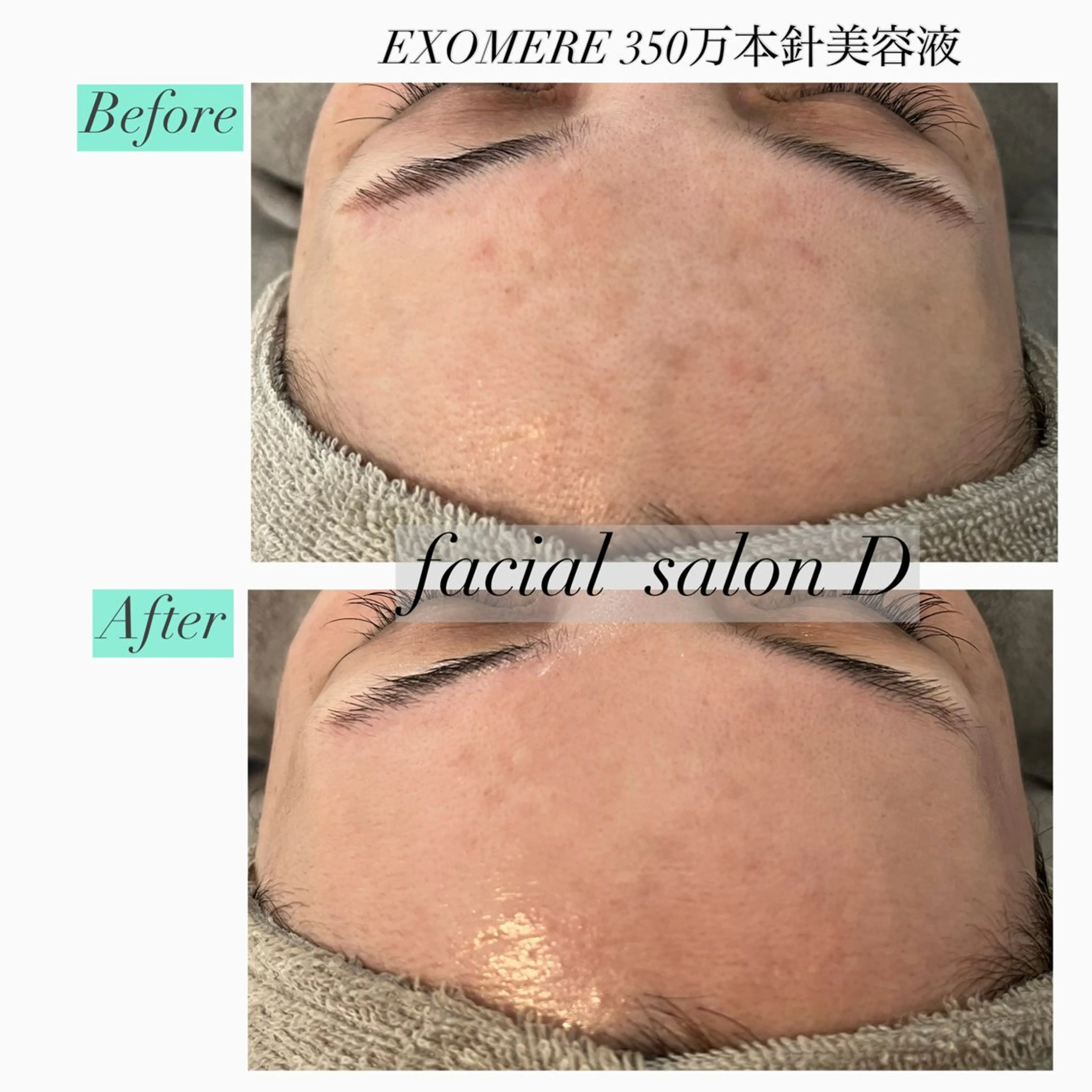 エステ リラク 【Salon D】 HALUのエステ・リラクイメージ