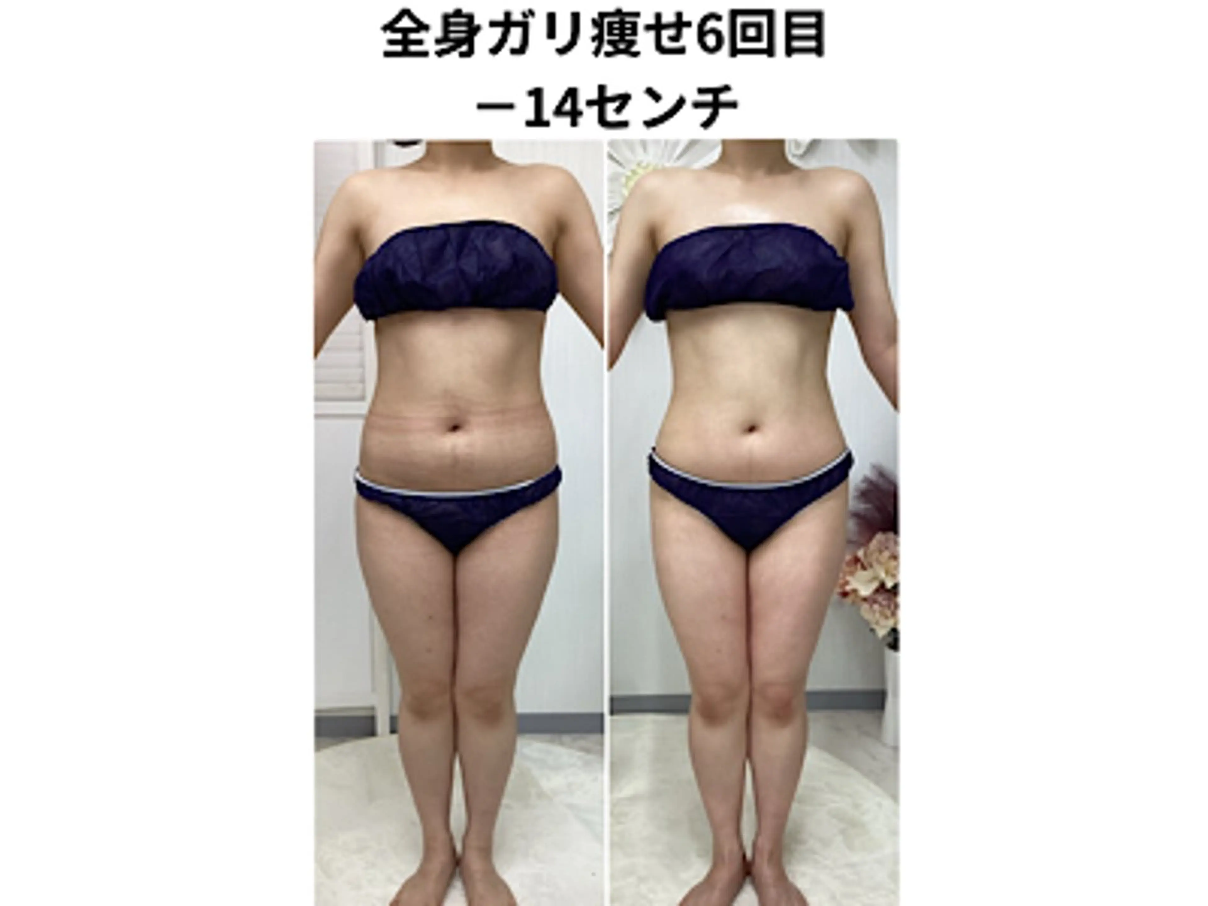 エステ 山村 しおんのエステ・リラクイメージ