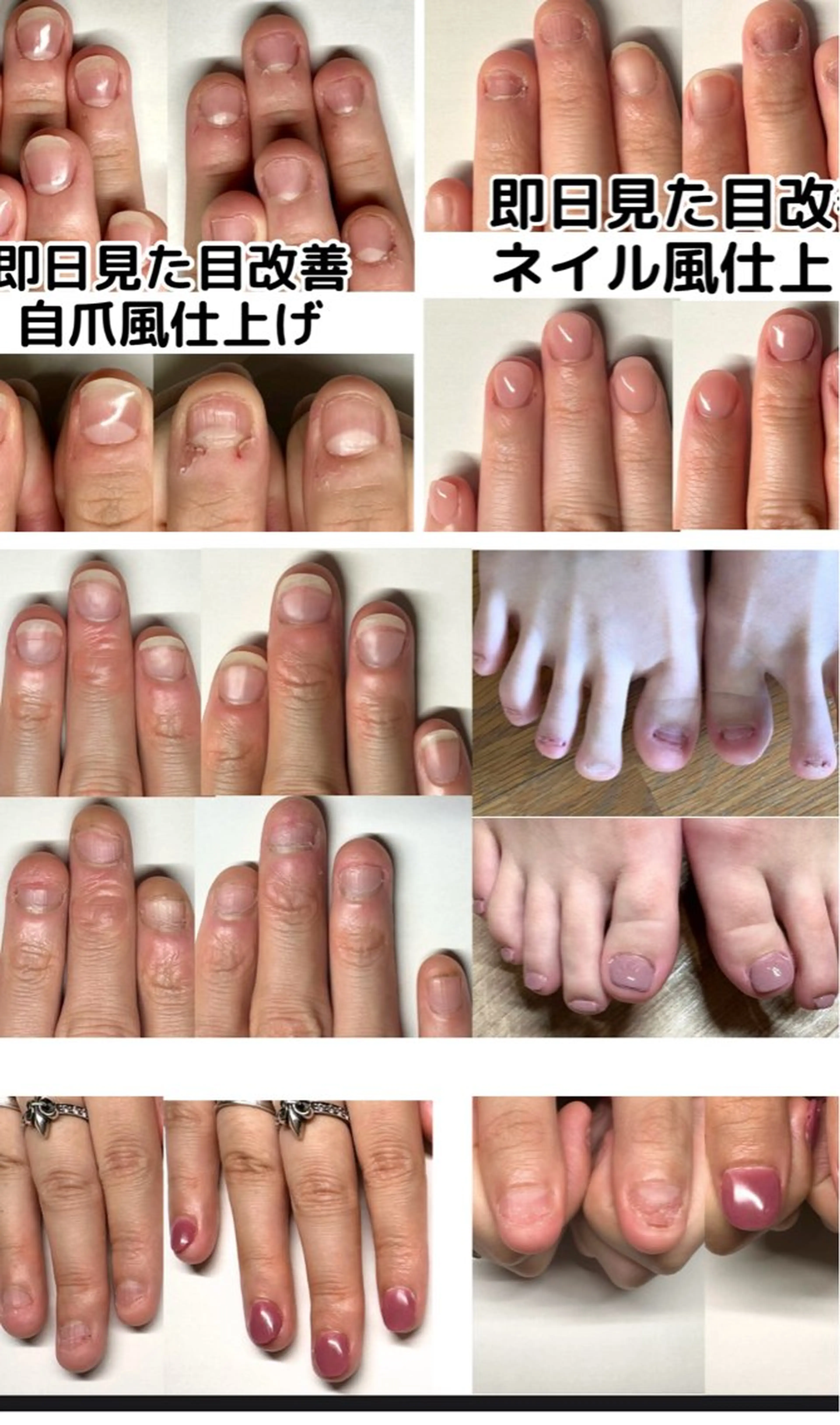 ネイル 深爪矯正専門店ネイルサロンKUU所属・ネイルサロン KUUのネイルデザイン