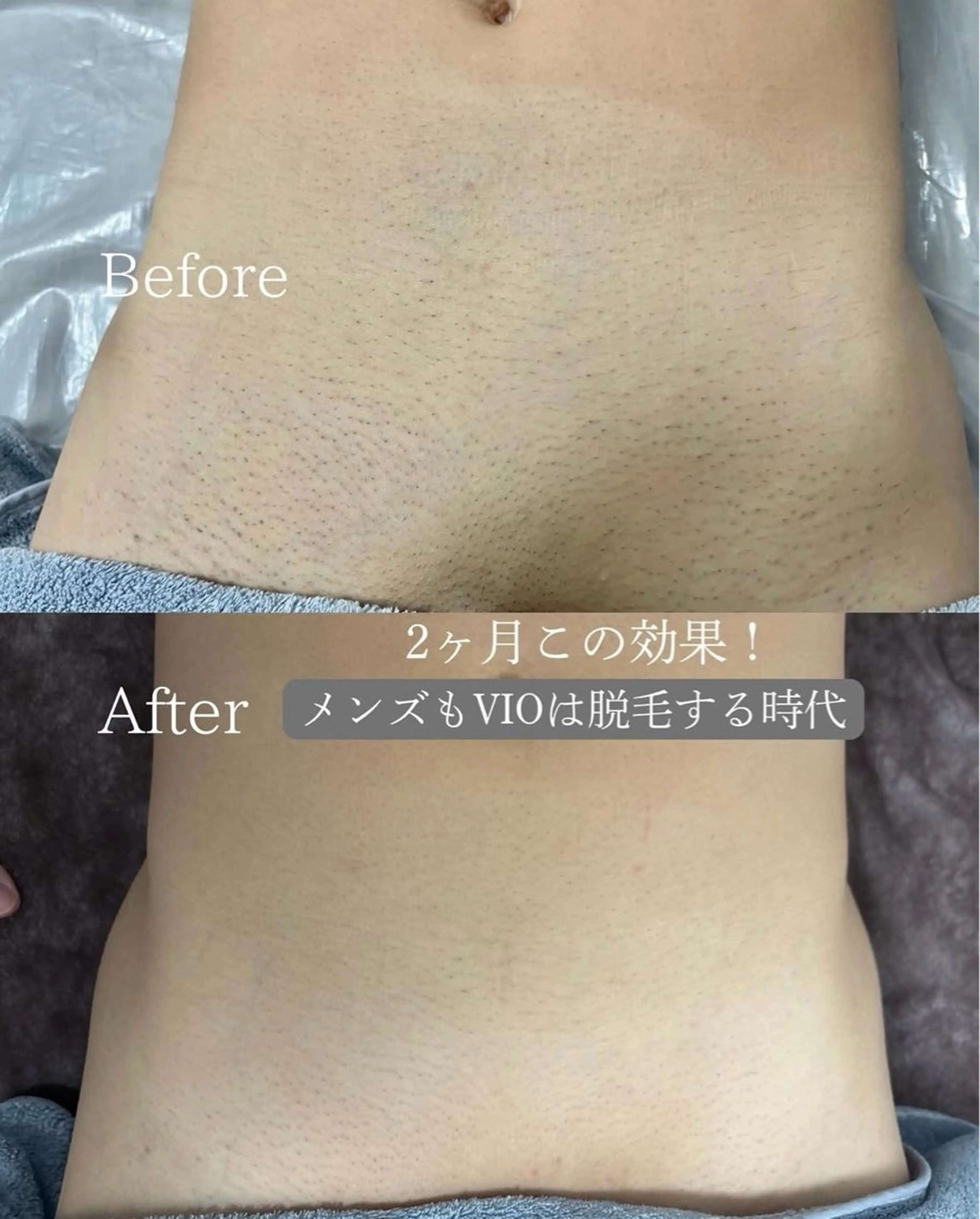 Libra所属・Libra 脱毛/ホワイトニングのその他イメージ