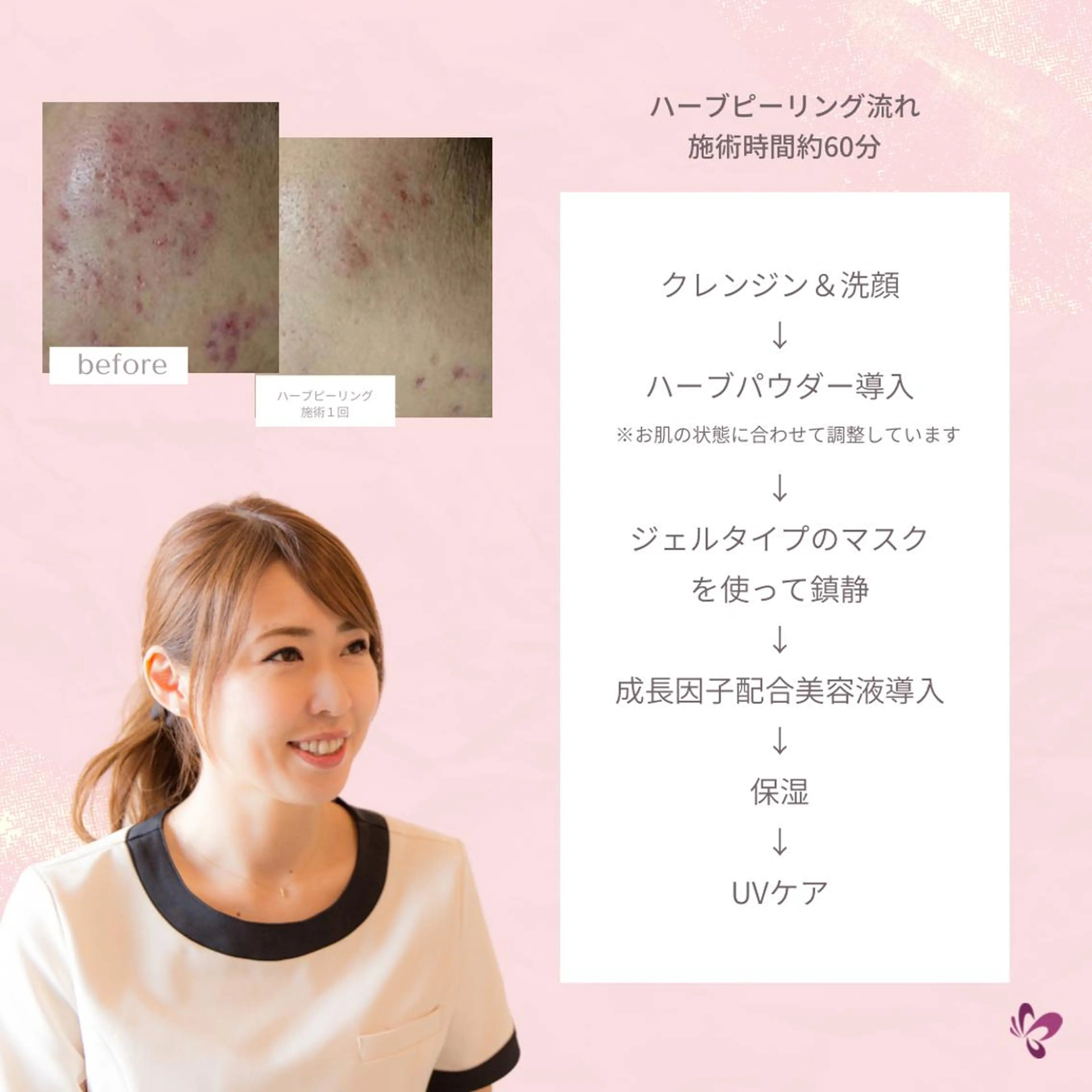 ベラージュ【美背中・ 美尻・フェイシャル】のエステ・リラクイメージ