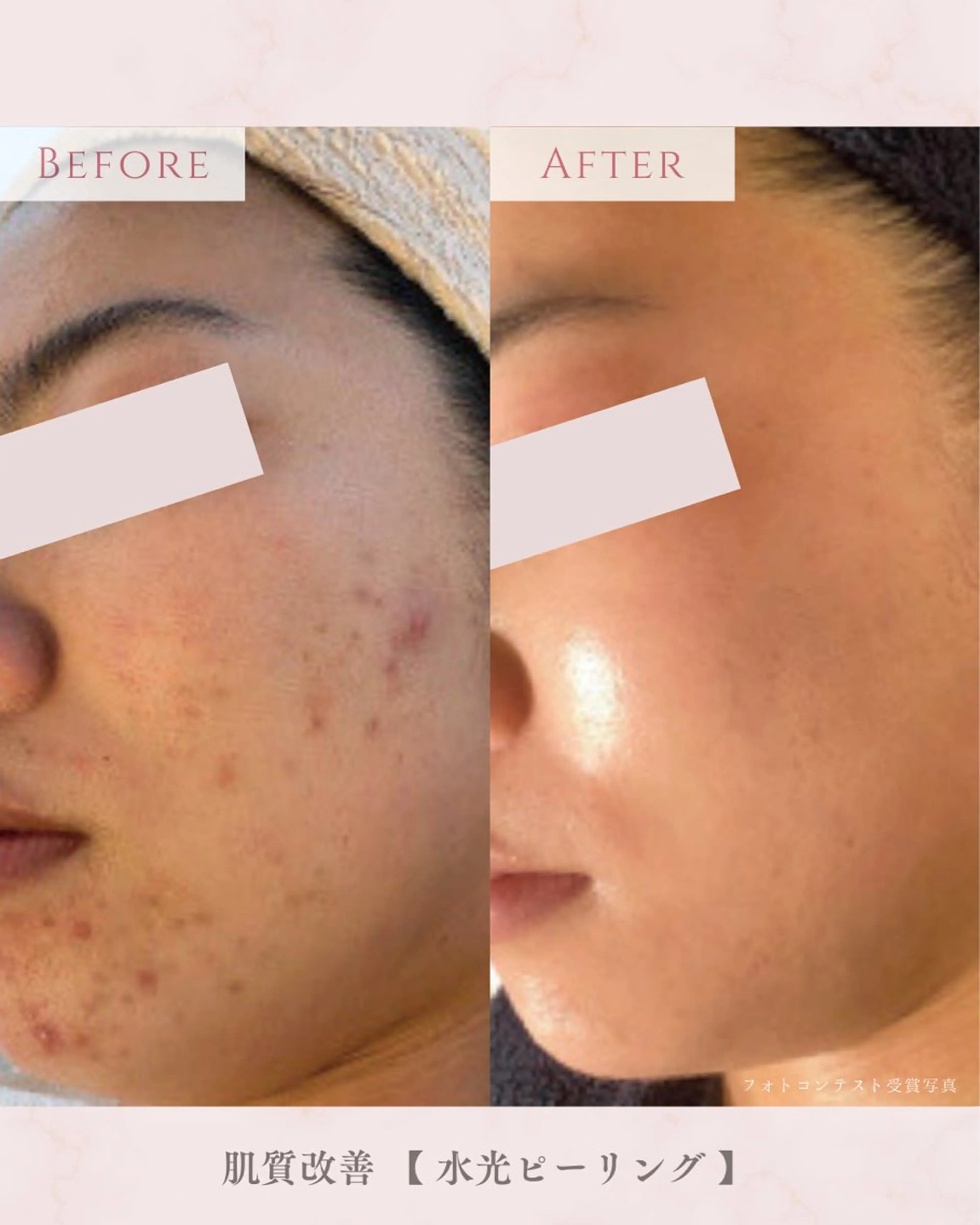 エステ 肌質改善サロン LesFleursのエステ・リラクイメージ