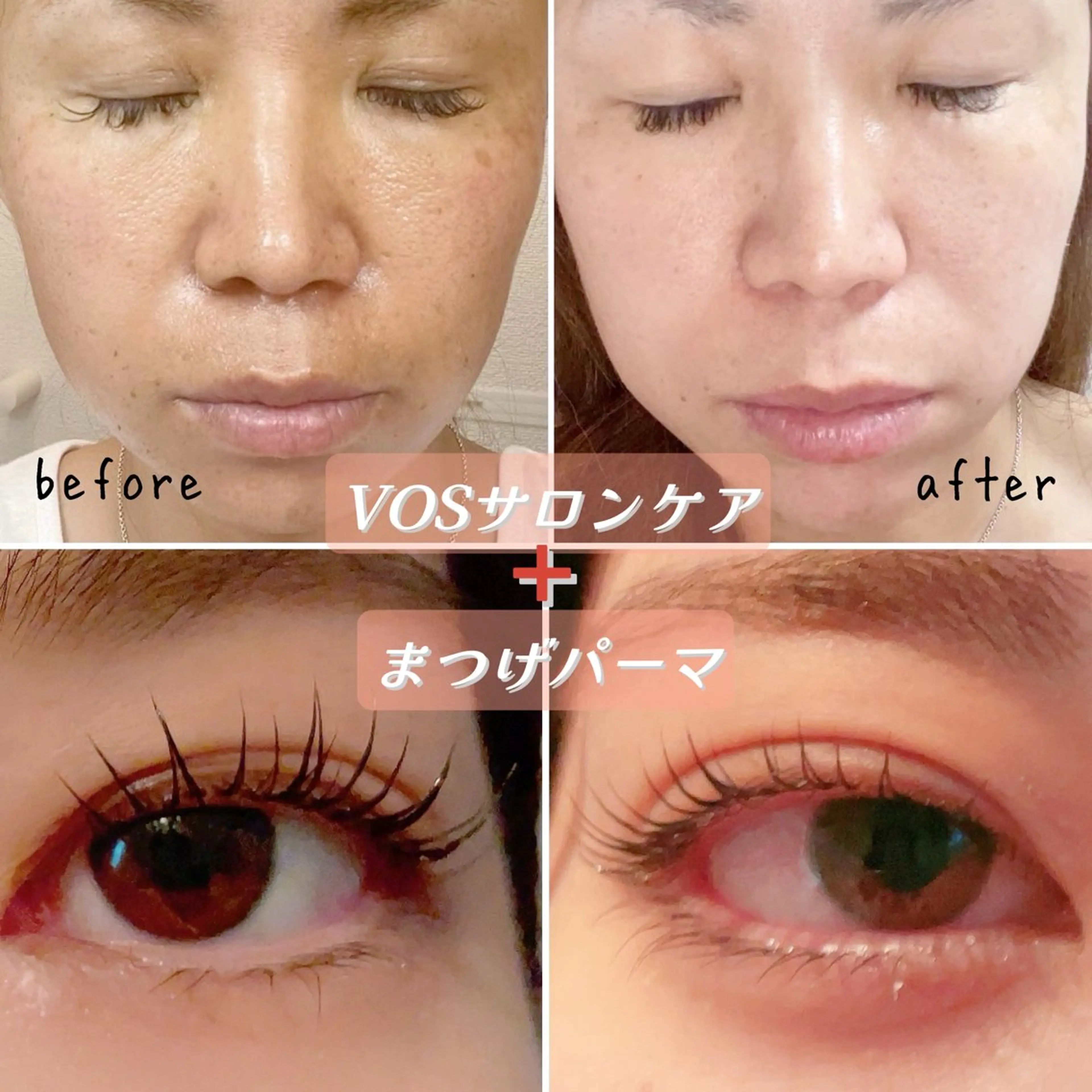 とってもお得💥【肌質改善】ニキビ・毛穴・シミ・シワなどお肌悩みに🌹フェイシャル+まつげパーマのセット16,000円の写真