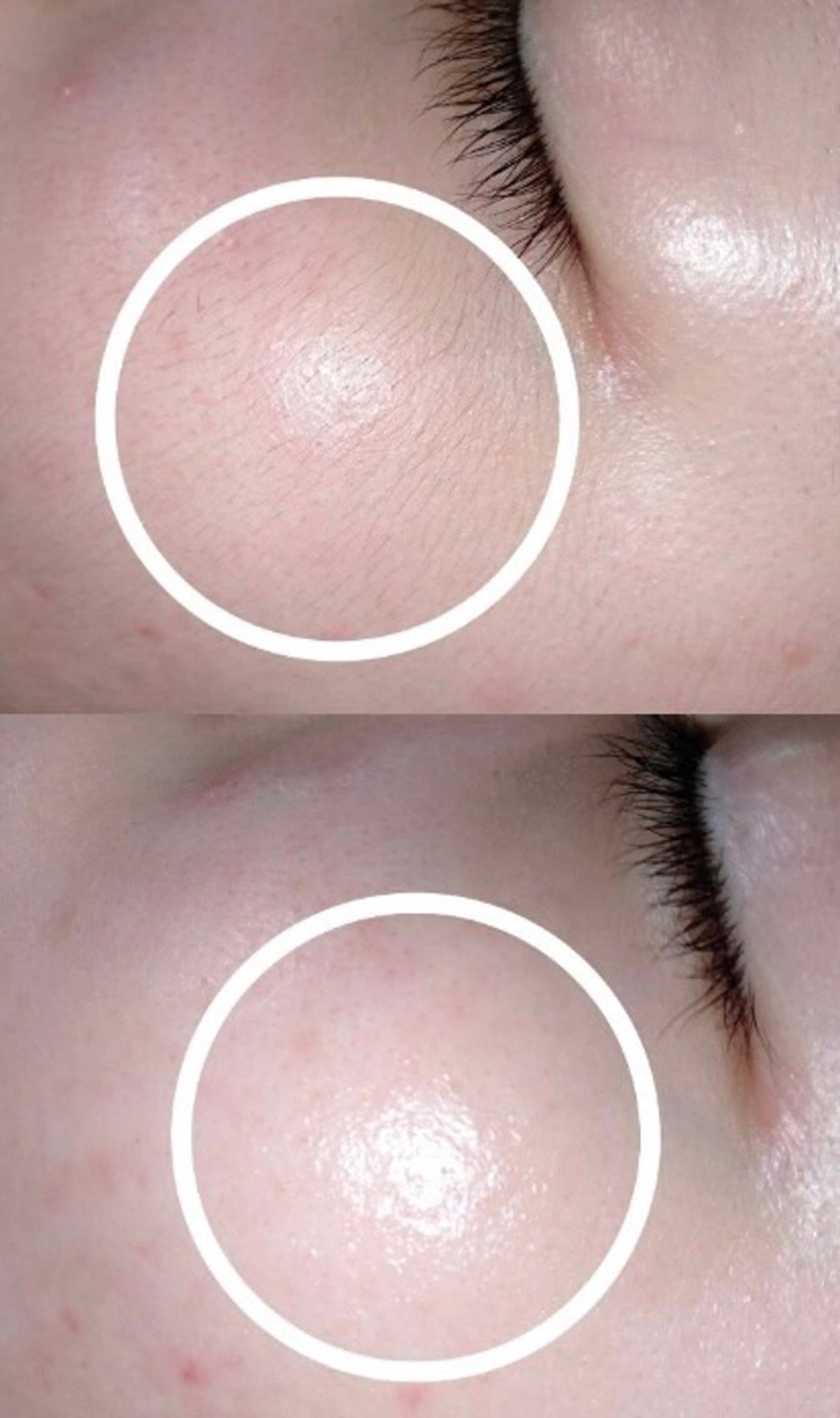 脱毛 中村 えり子のエステ・リラクイメージ